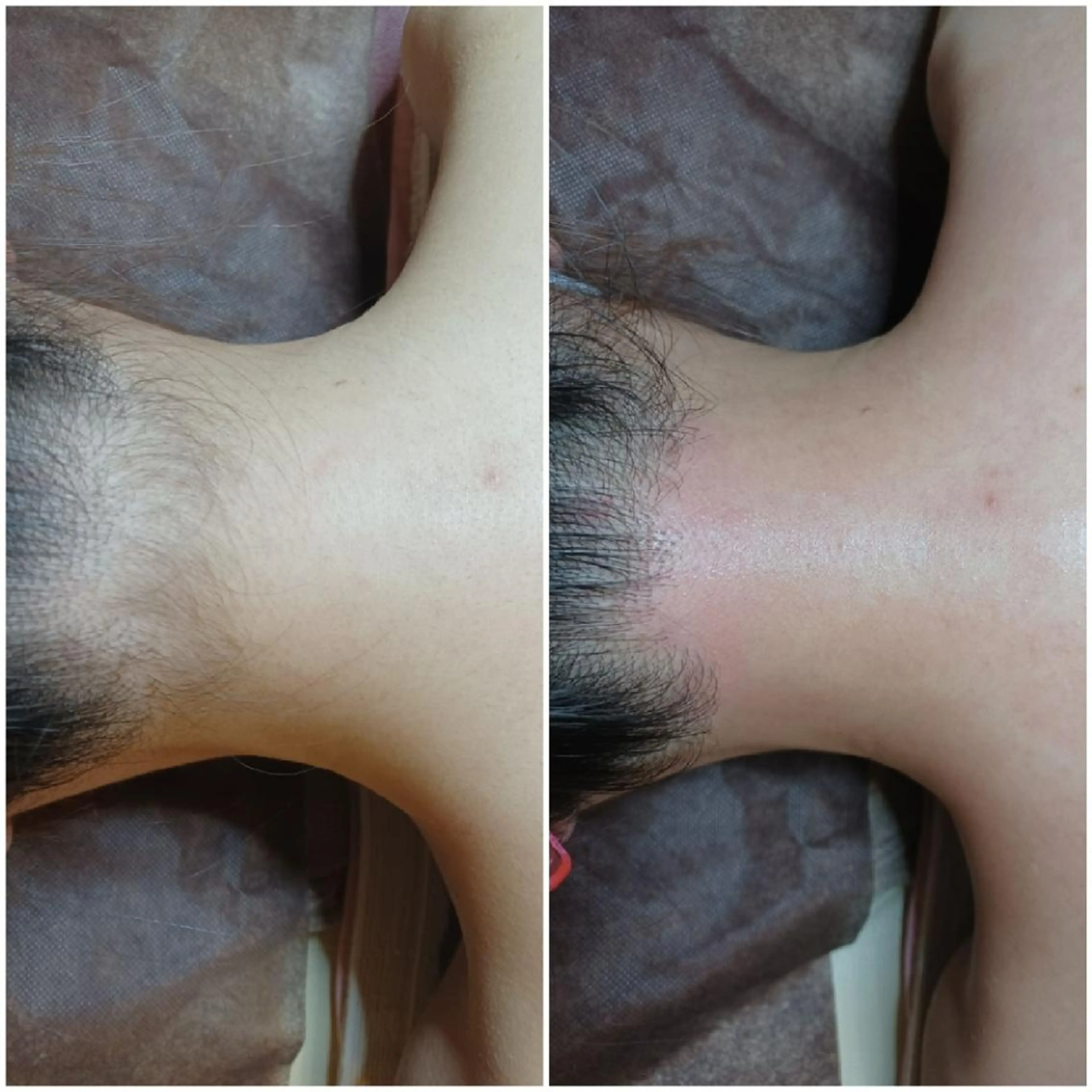 Lutella所属・ワックス脱毛専門店 Lutellaのエステ・リラクイメージ