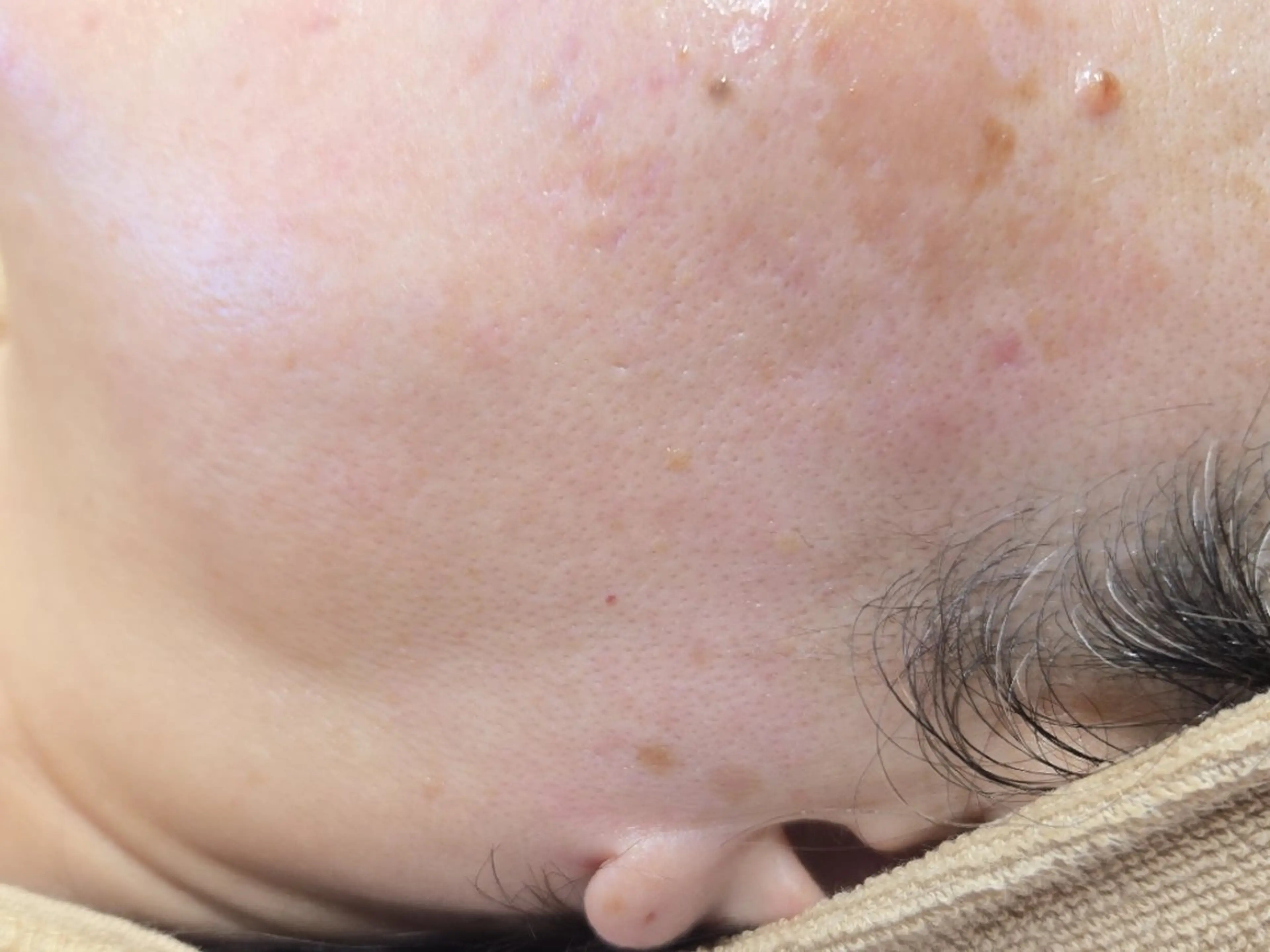 フェイシャルワックス GLOW所属・渡邊 真依のエステ・リラクイメージ