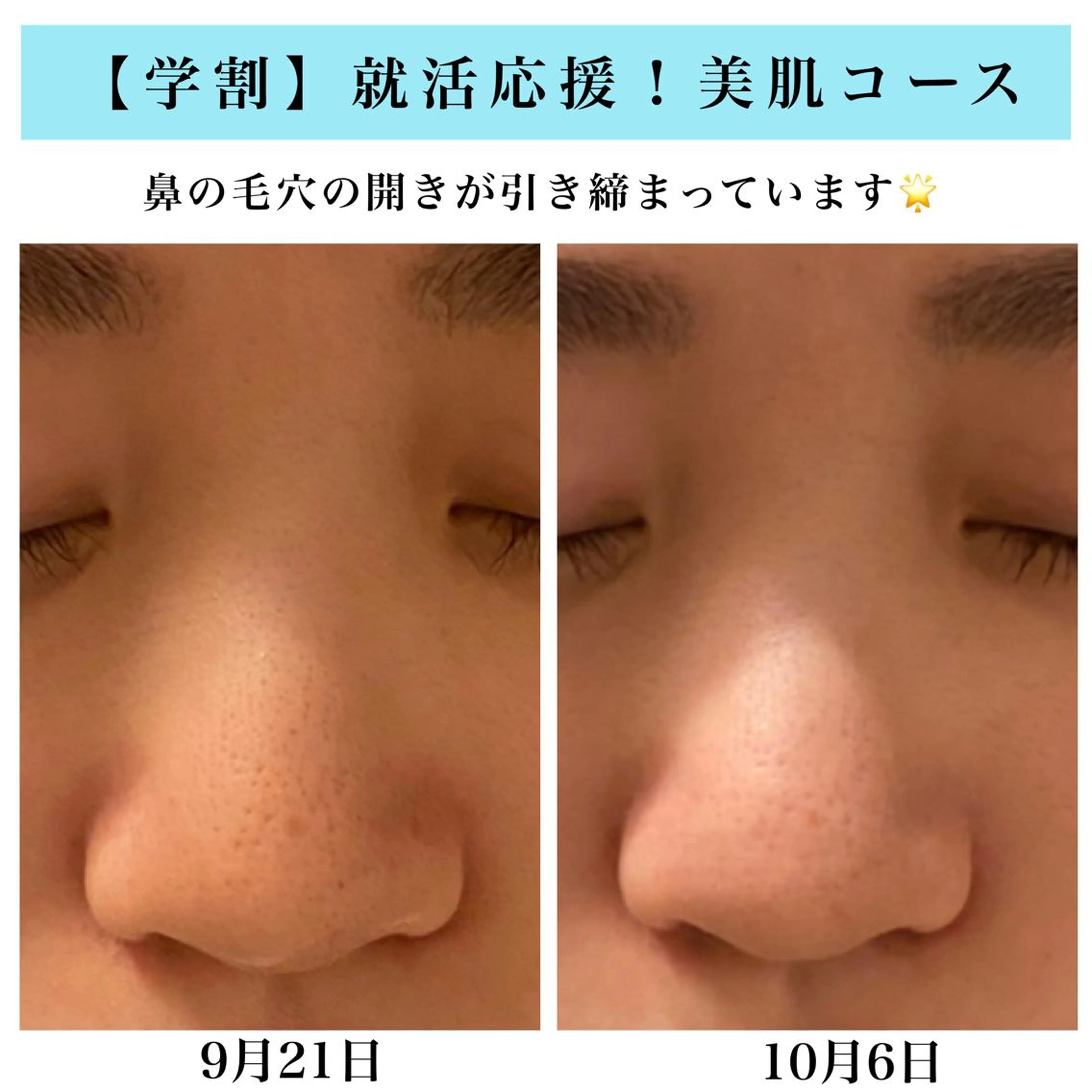 エステ Bellesthe (ベルエステ)のエステ・リラクイメージ