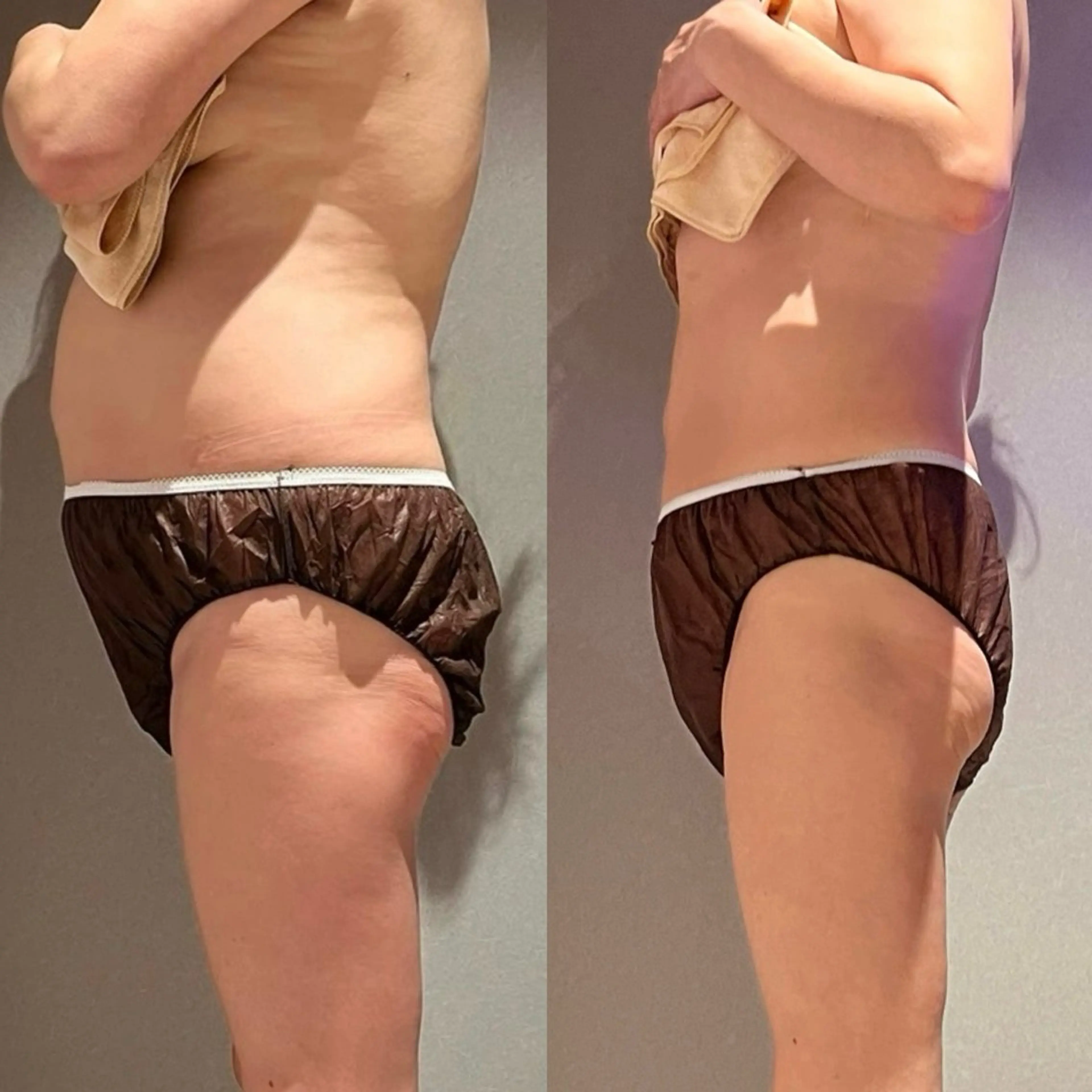 癒しゼロ　熱血エステ FEMBE本八幡店のエステ・リラクイメージ