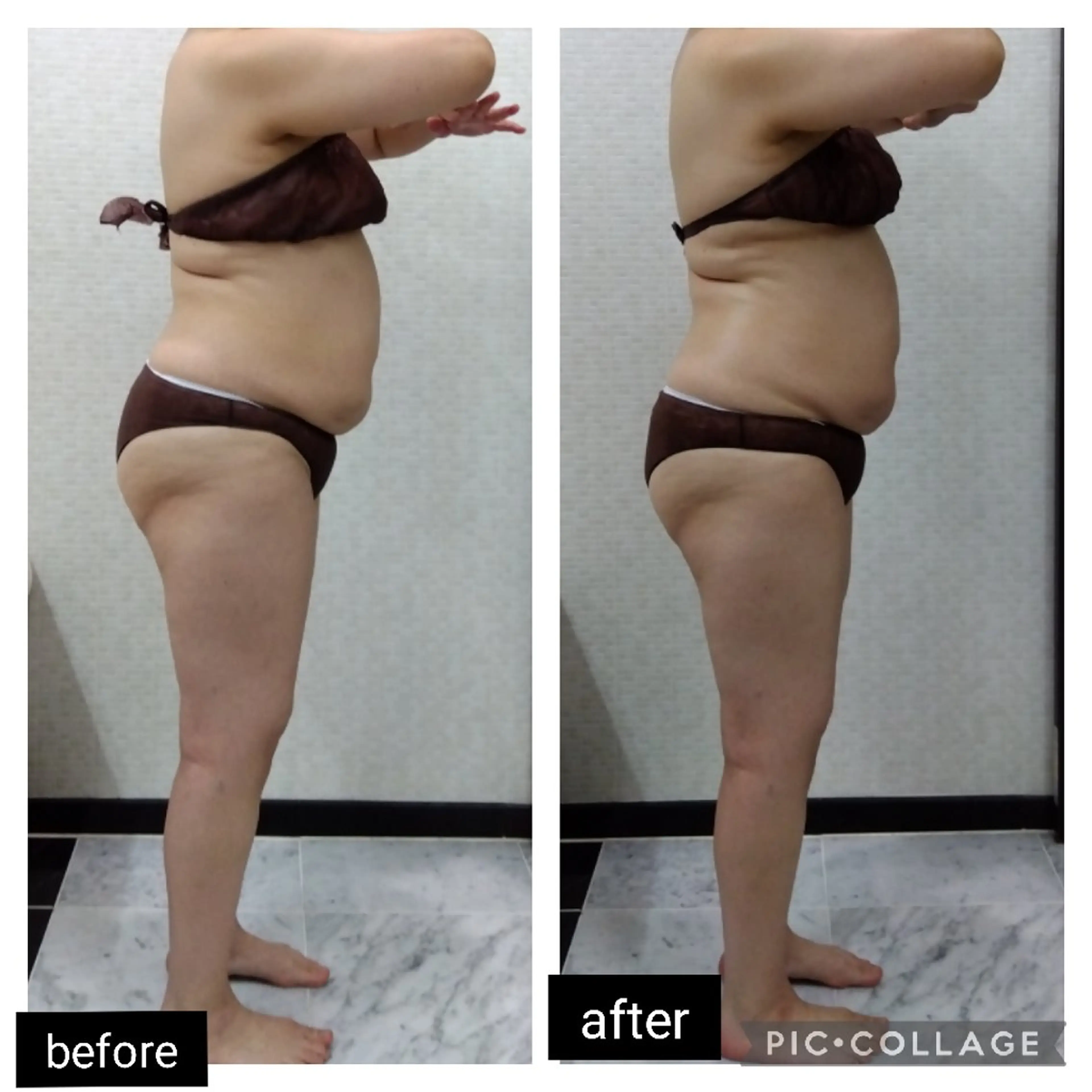 【人気No.1】骨盤矯正付き☆オールハンド筋膜リリース痩身エステ120分 通常価格￥13,900の写真