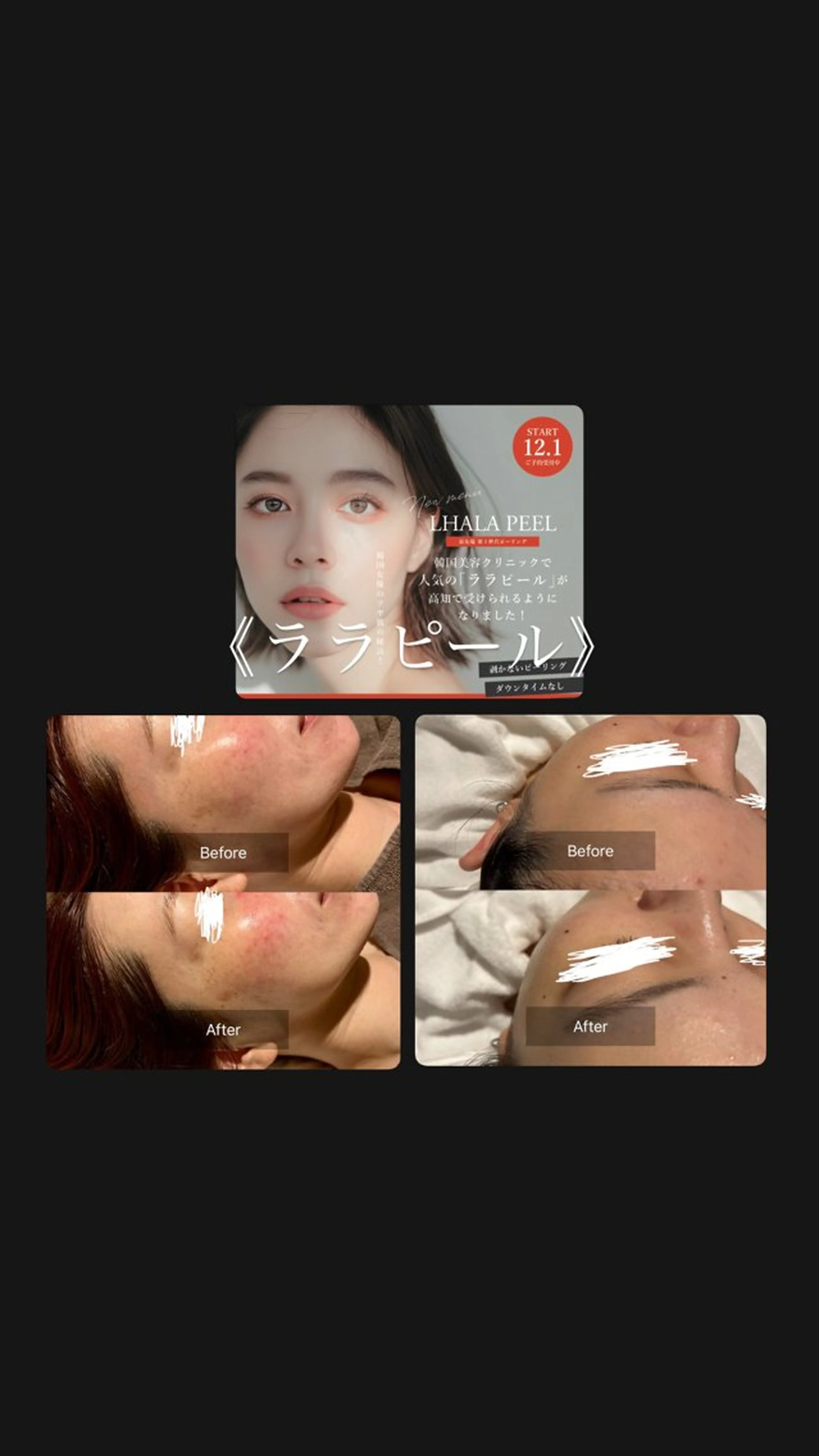 💎ボディエステ＆ 脱毛＆スパ💎山岡のエステ・リラクイメージ