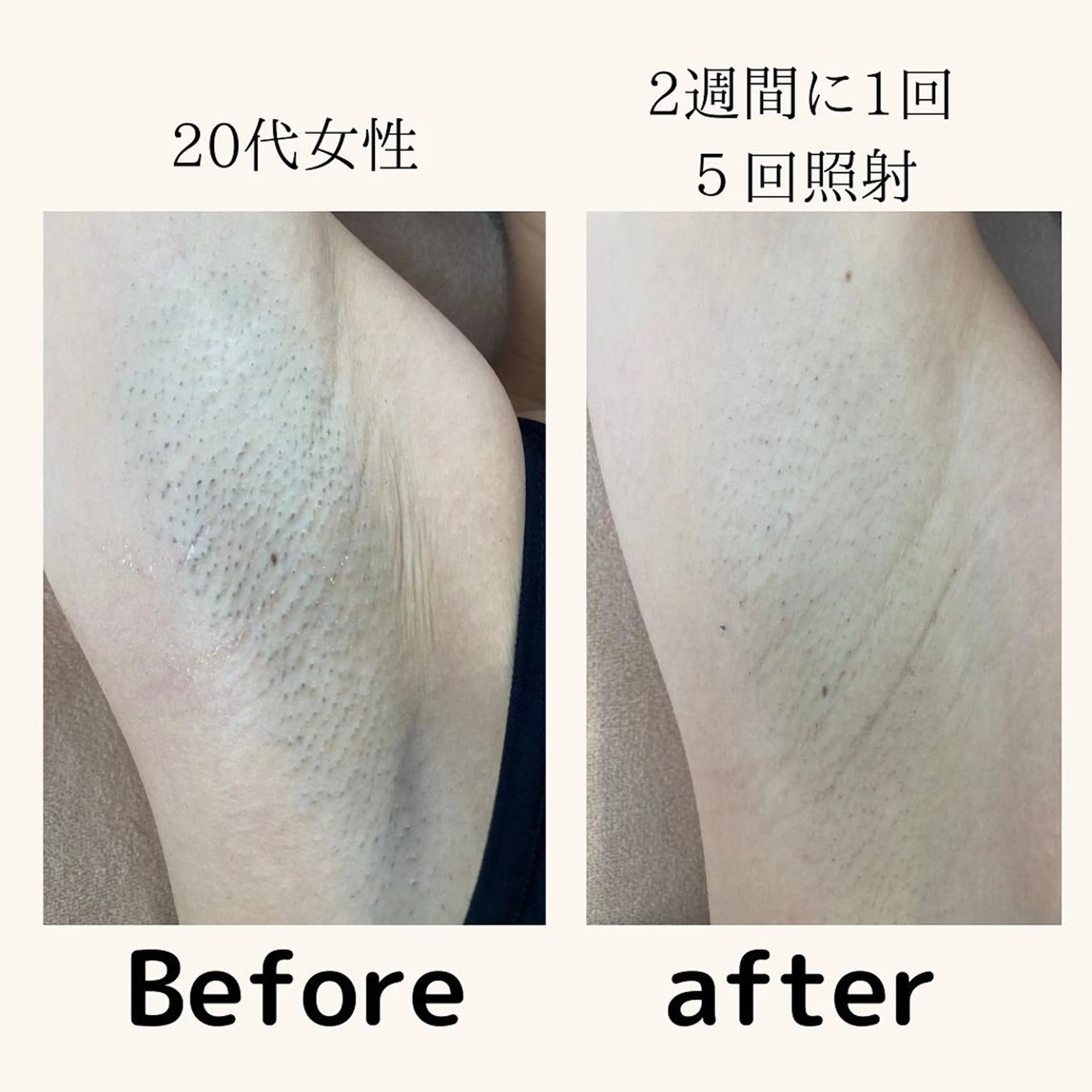 美肌サロン Kooのその他イメージ