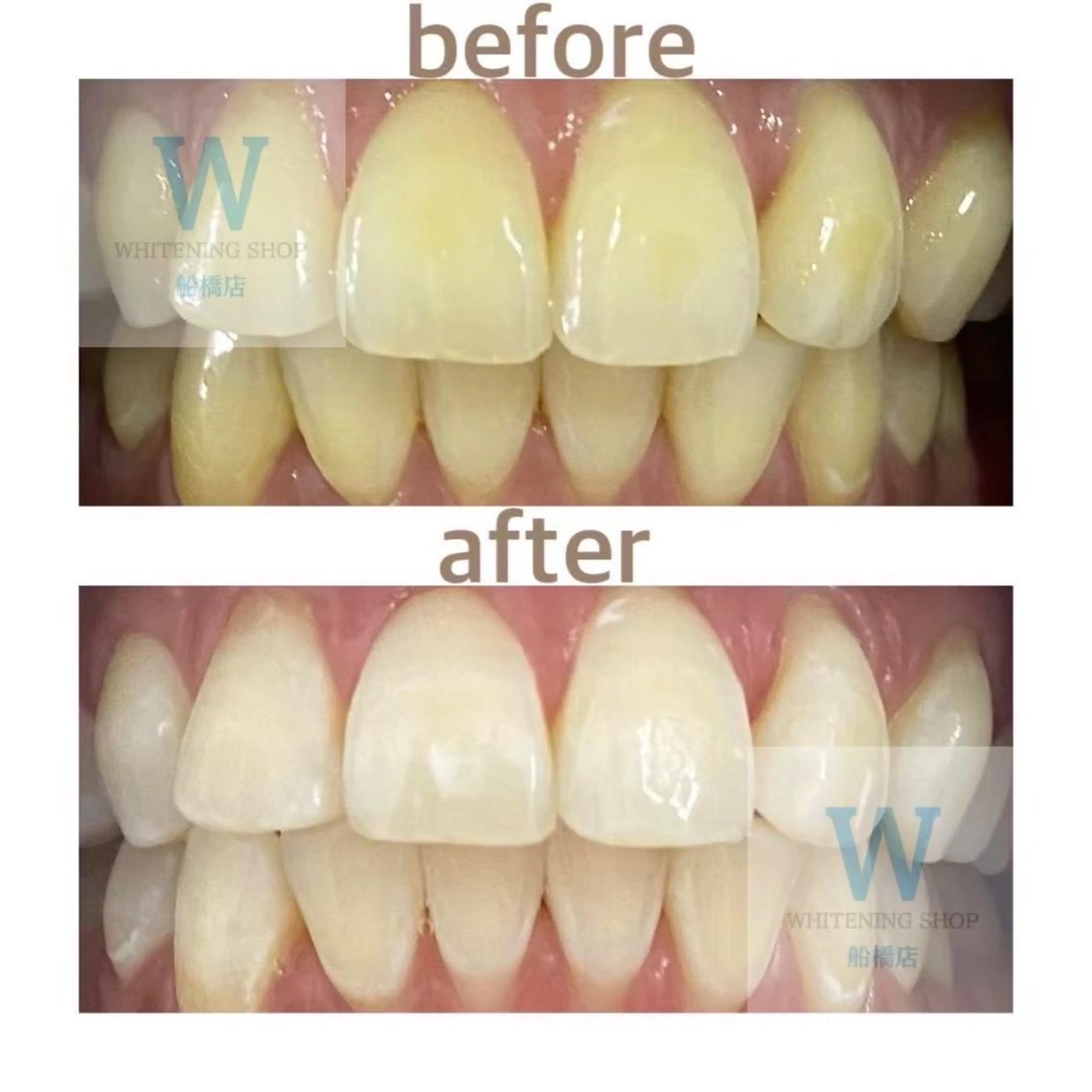 エステ リラク ホワイトニング ショップ船橋2号店のエステ・リラクイメージ