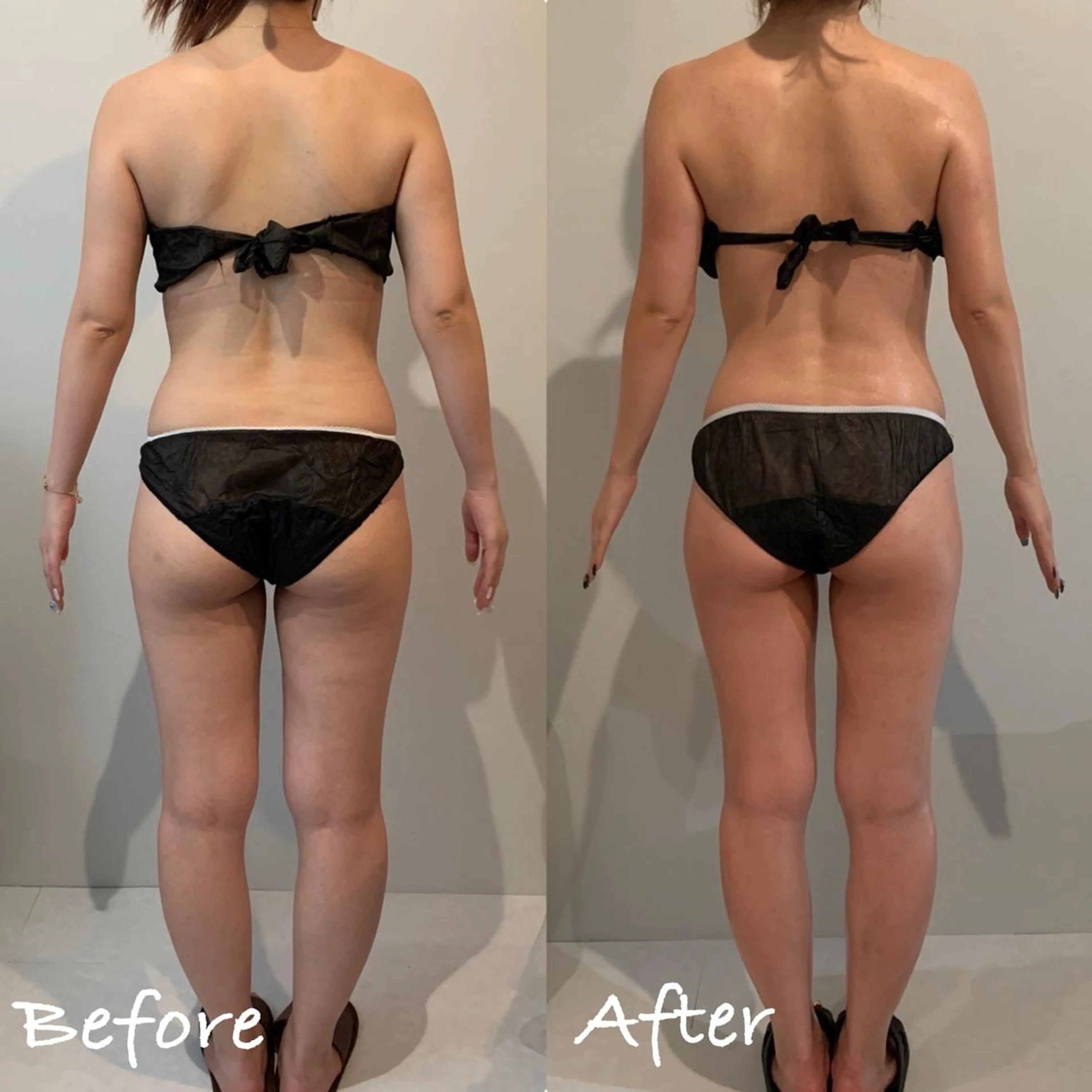 エステ リラク ボディメンテナンス shinomaのエステ・リラクイメージ