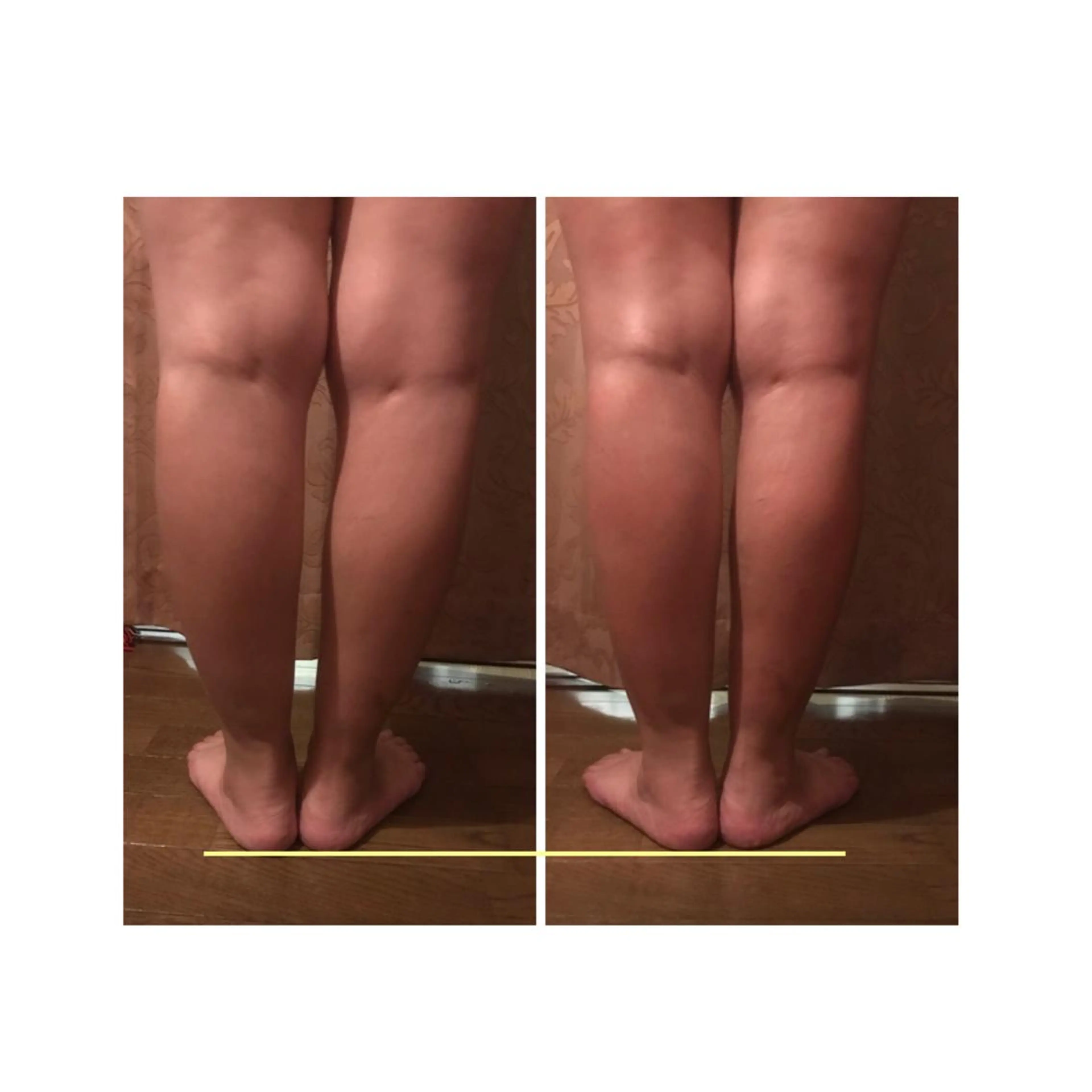 代表 MOMOのエステ・リラクイメージ