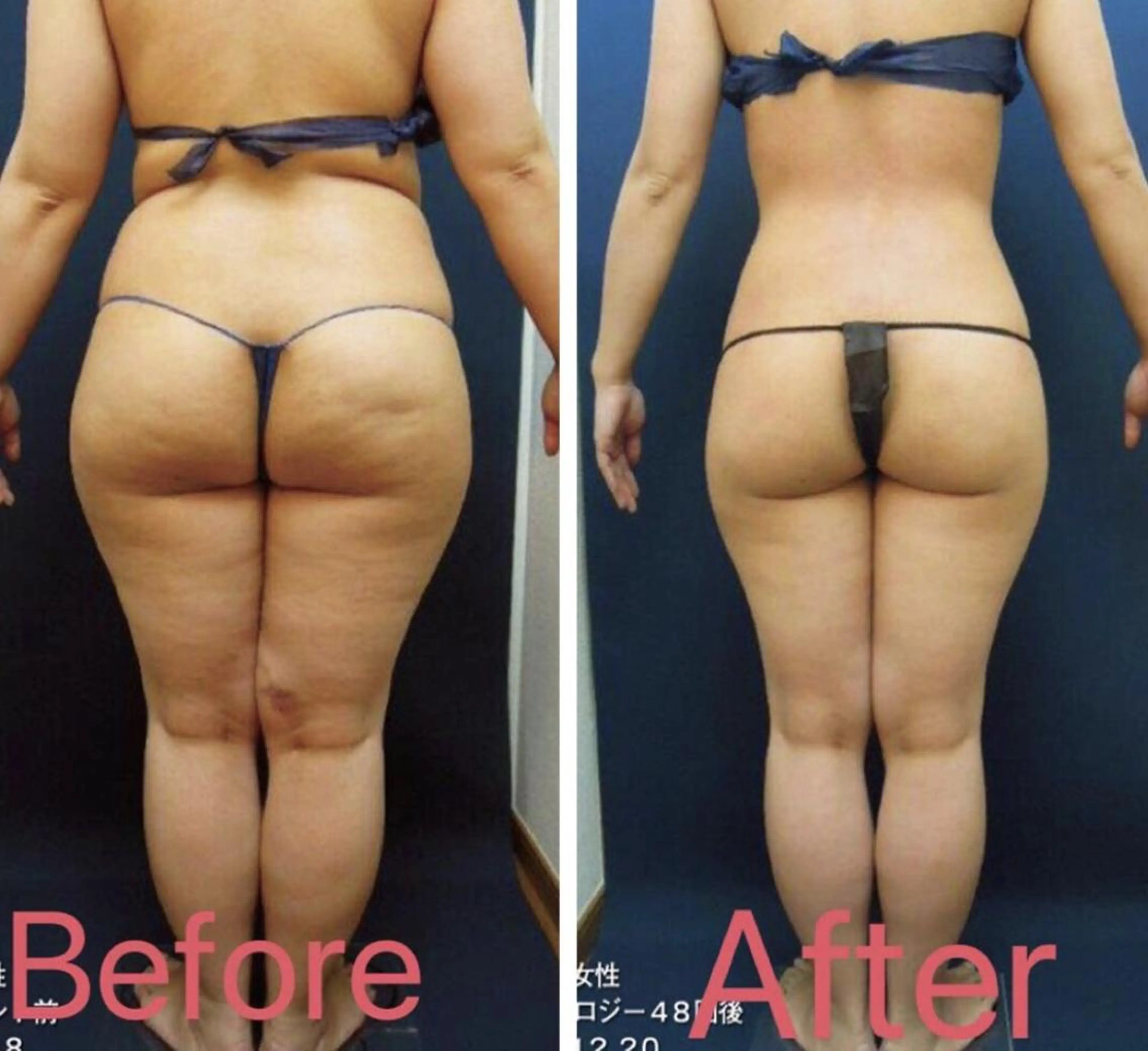 エステ BELINDA銀座店 ✨痩身エステサロン✨のエステ・リラクイメージ