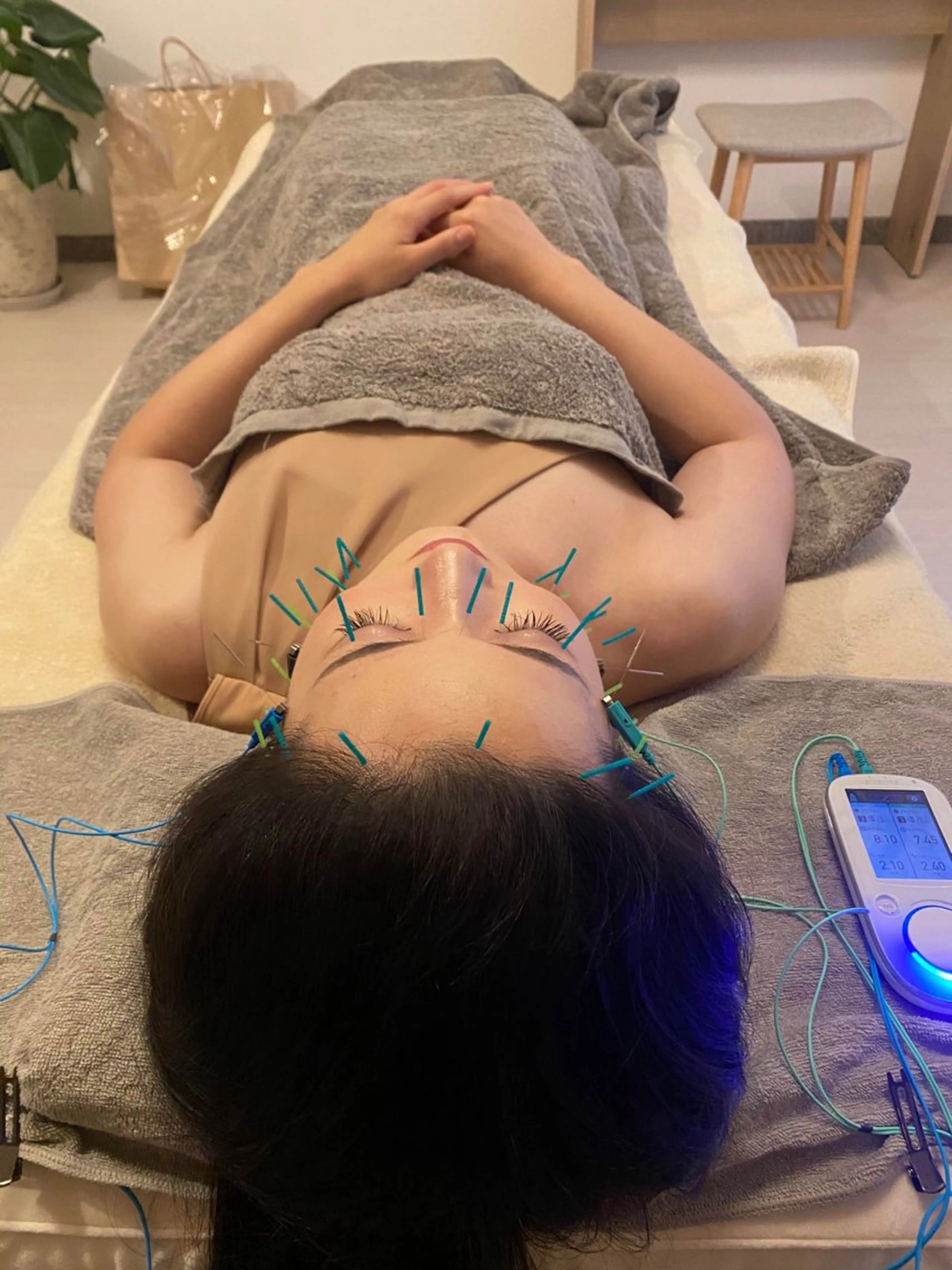 鍼灸•マッサージサロンCalfa所属・《美肌･小顔》美容鍼 ＆マッサージ＊MEIのエステ・リラクイメージ