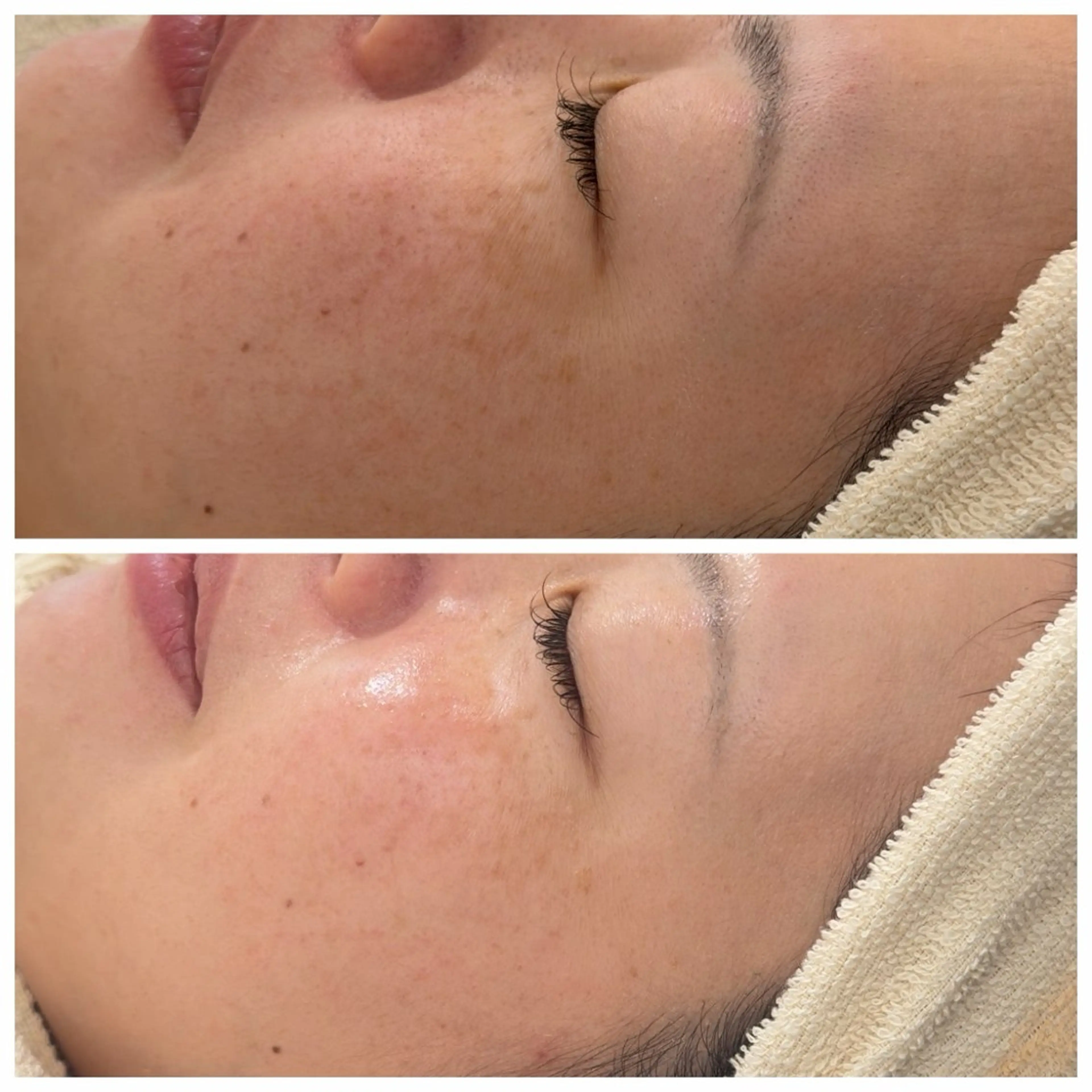 エステ Raviy 【痩身・韓国肌管理】のエステ・リラクイメージ