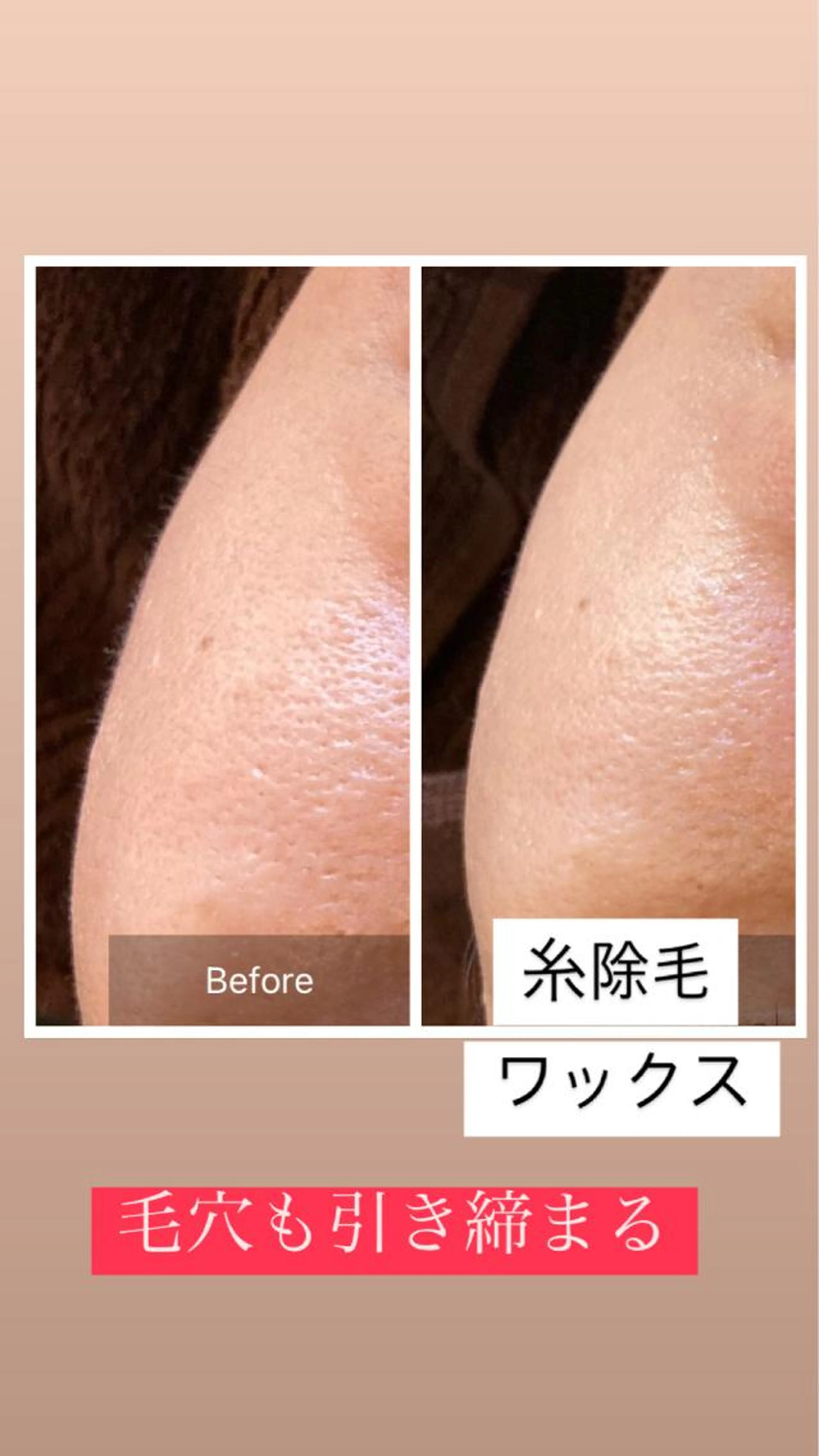 フェイスWax（2ヶ月以内）の写真