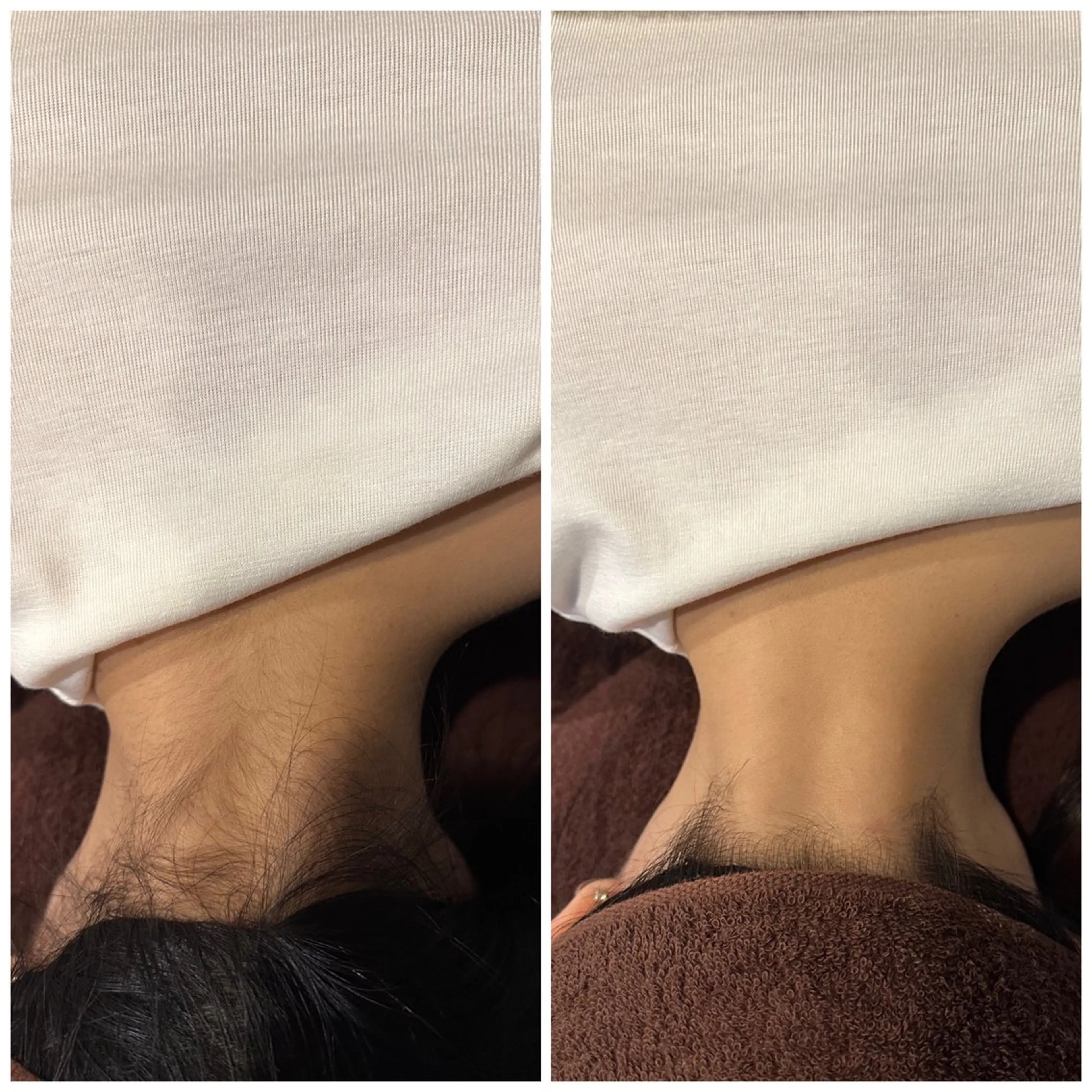 脱毛 ツヤ肌脱毛サロン Grast🌿アイカのエステ・リラクイメージ