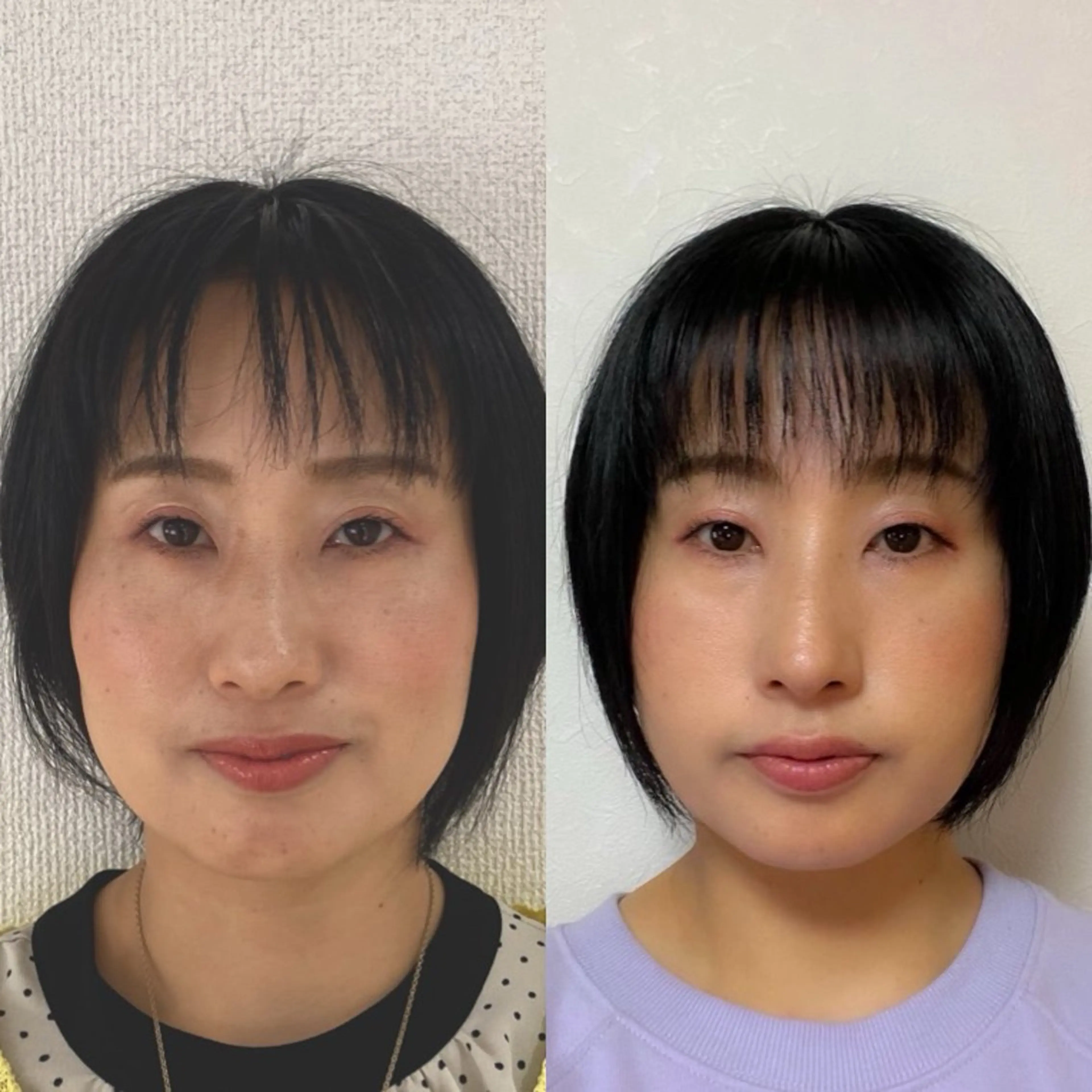 エステ リラク 小顔矯正サロン町田 逸見智美のエステ・リラクイメージ