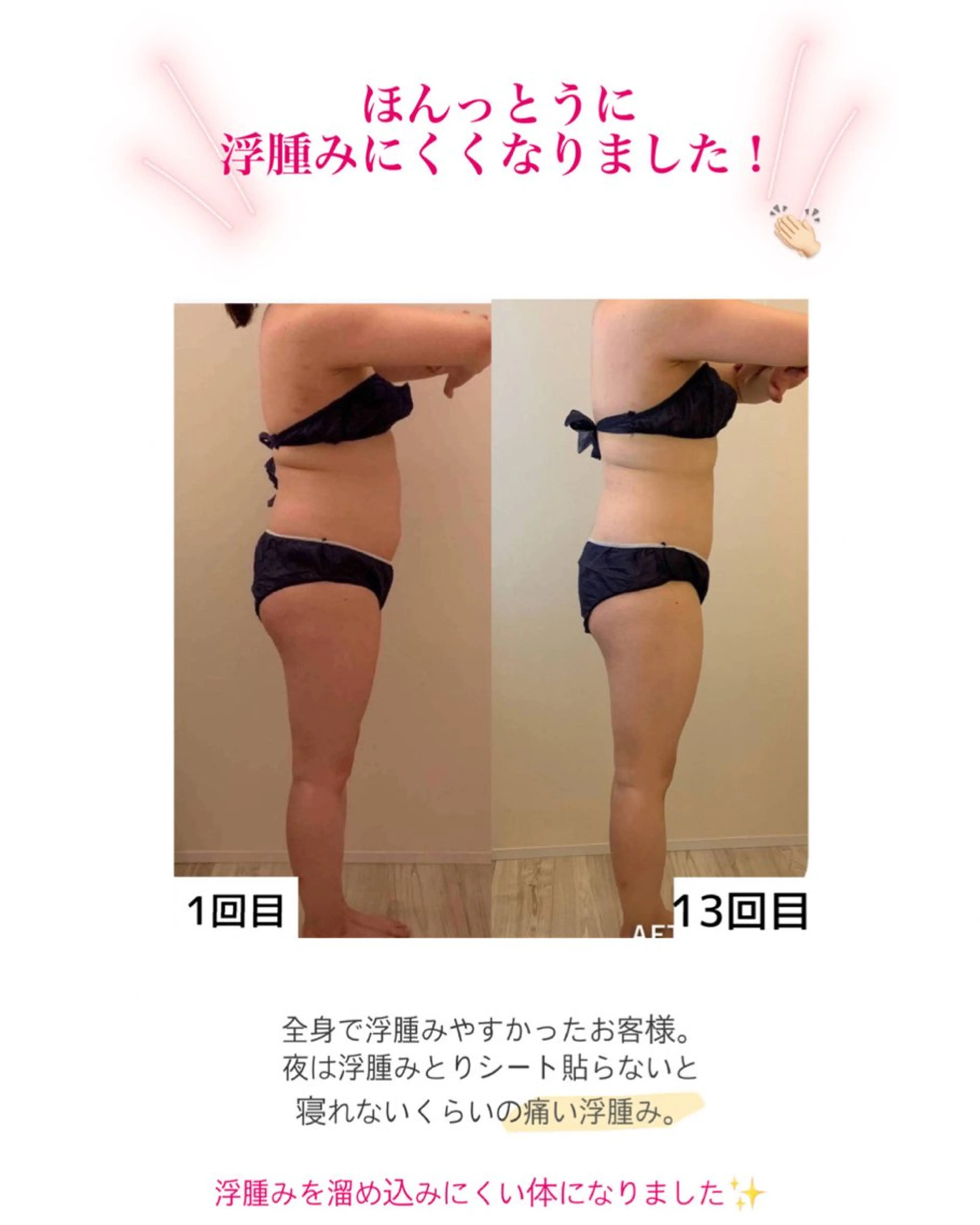 産後ダイエット−9㎏ Pourvous結衣のエステ・リラクイメージ