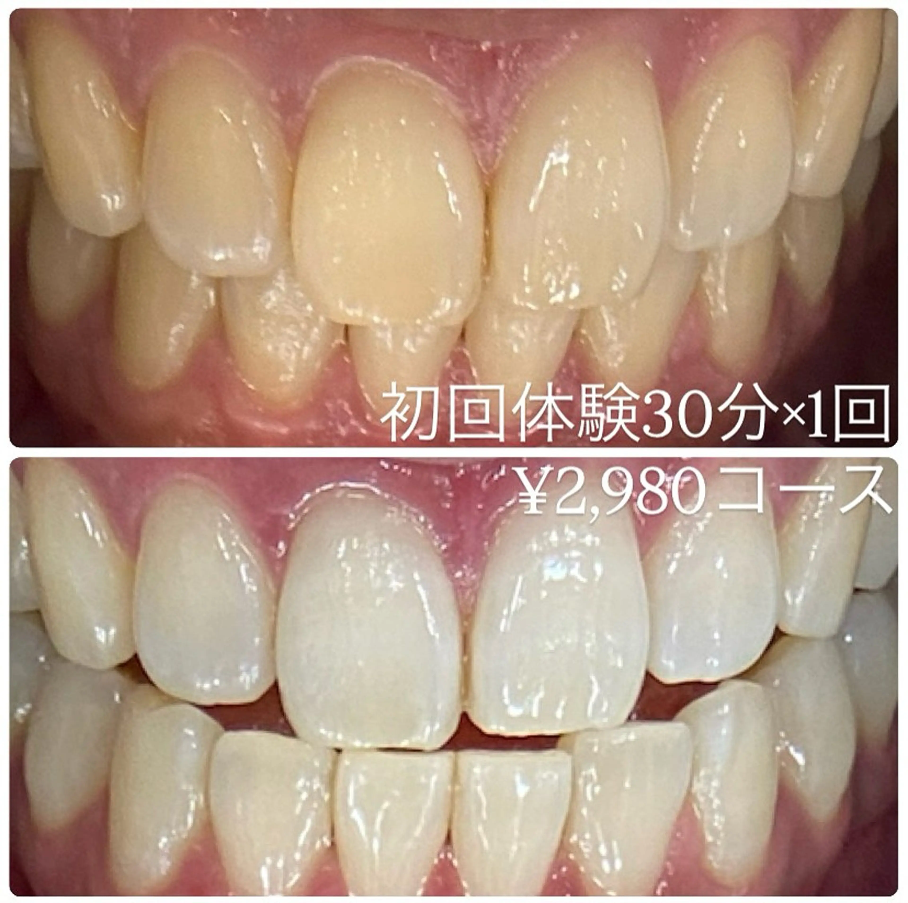 PLATINUM Beauty 横浜店所属・ホワイトニングルーム 横浜店のその他イメージ