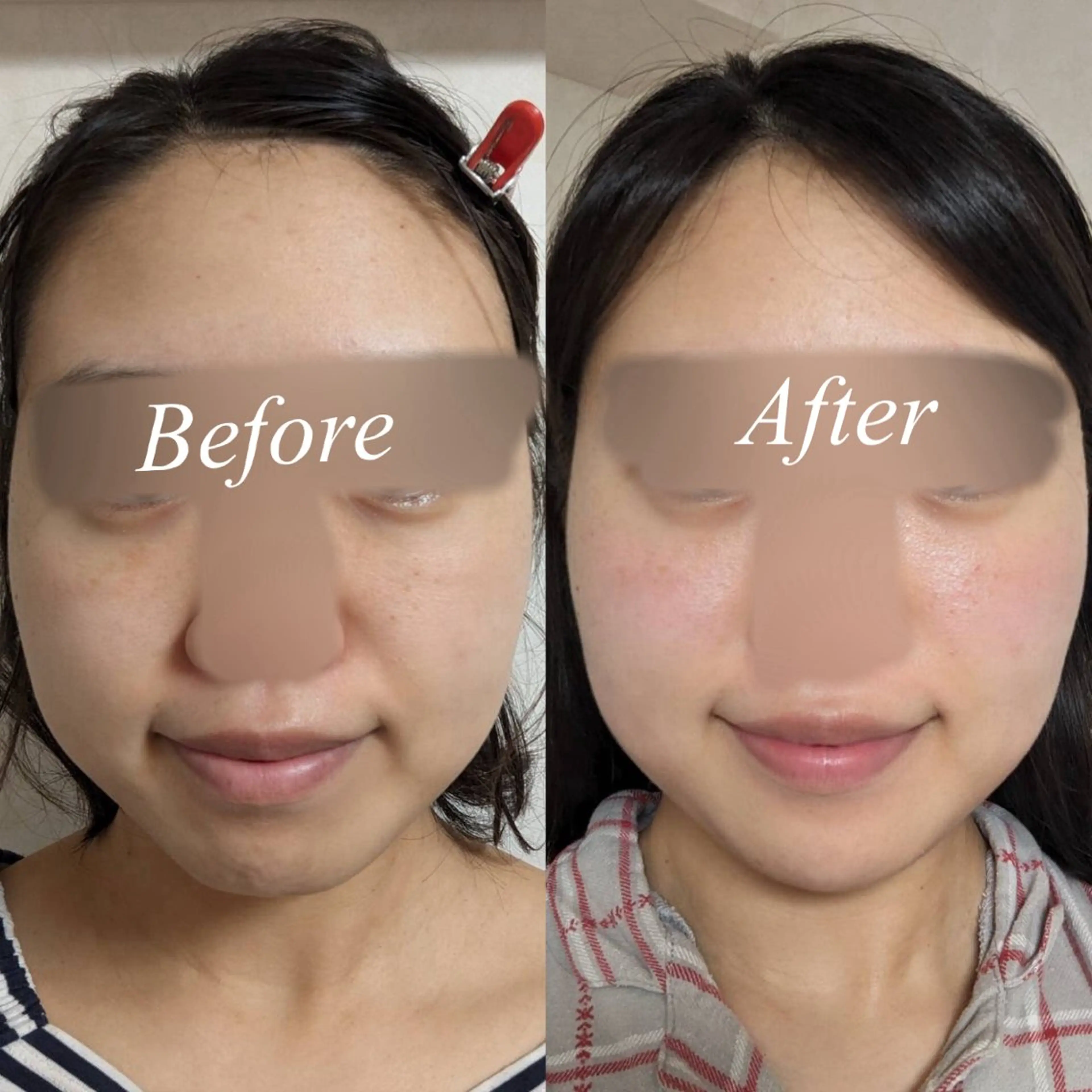 肌質改善サロン🌕 ⠀【ルーナピエナ】のエステ・リラクイメージ