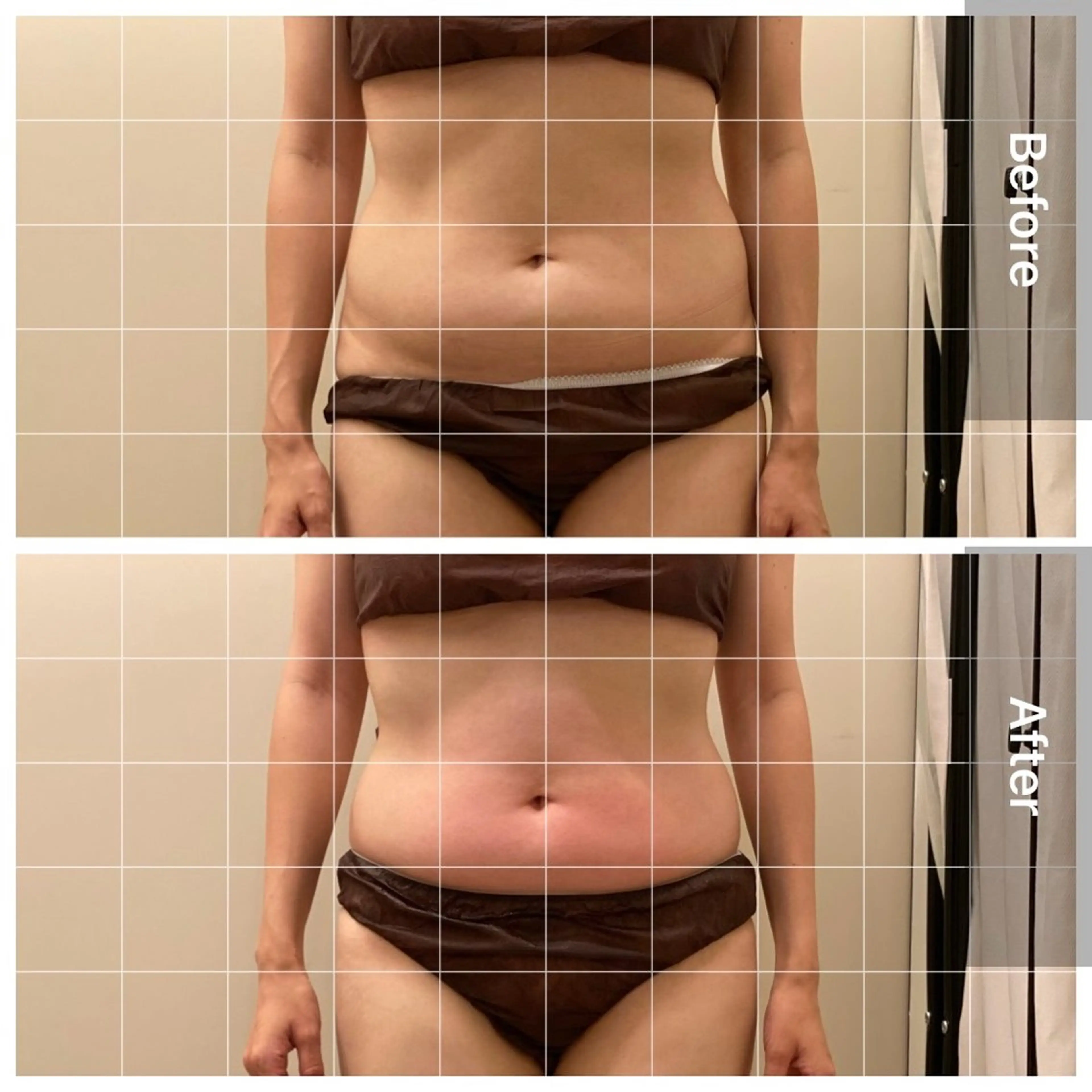 美容鍼/ヘッドスパ/ 💎さかもとのエステ・リラクイメージ