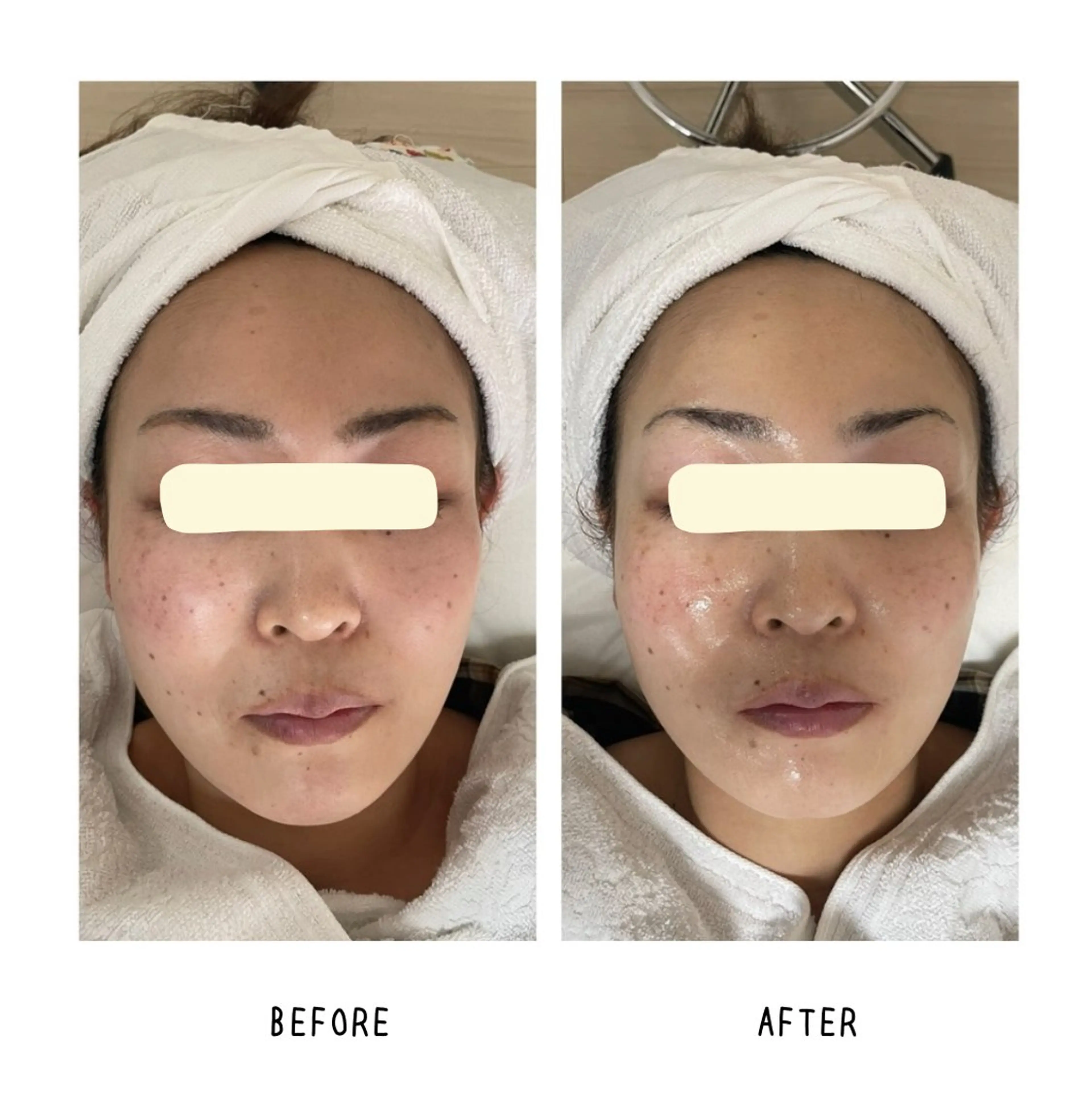 Yoshino Erinaのエステ・リラクイメージ