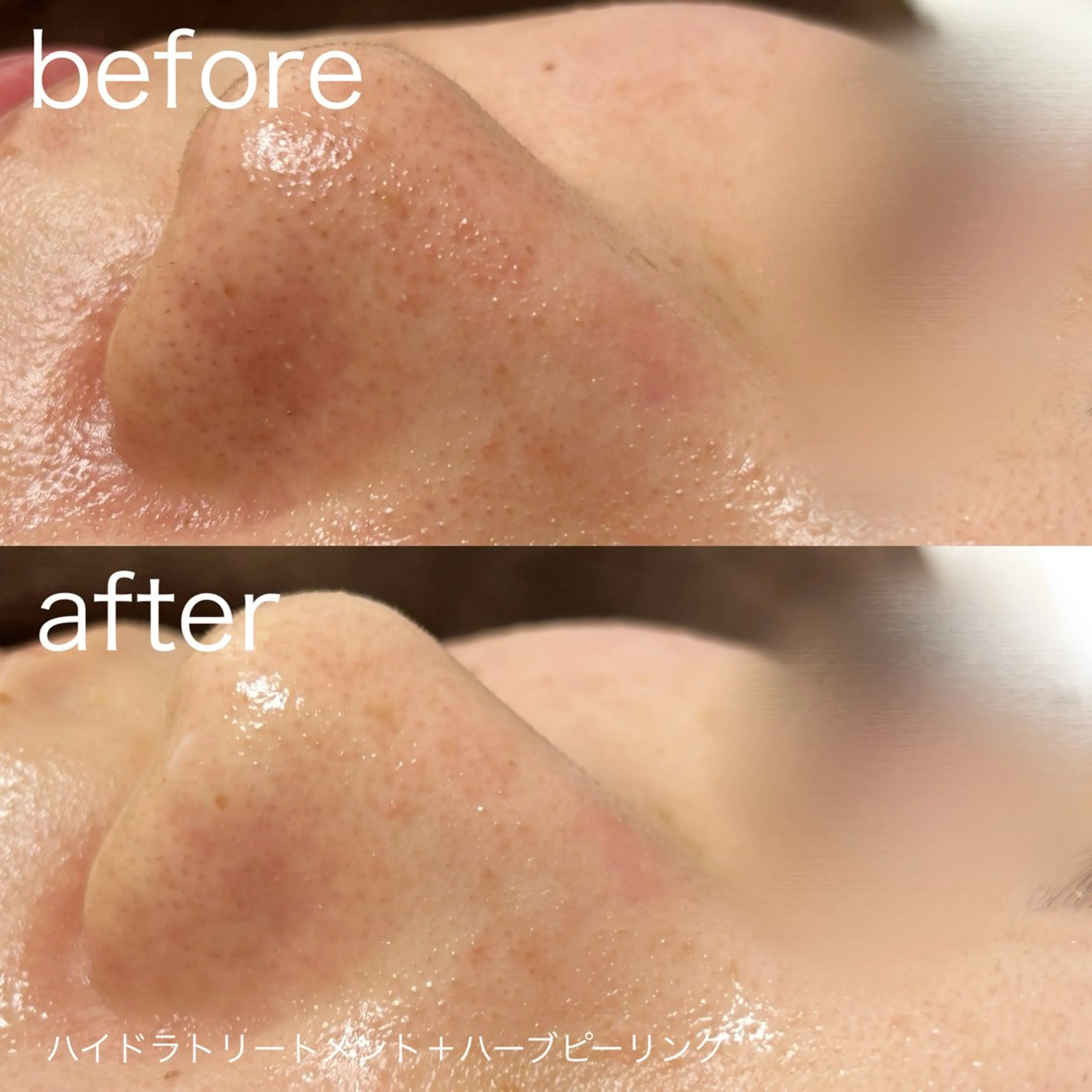 lulularico Yuのエステ・リラクイメージ