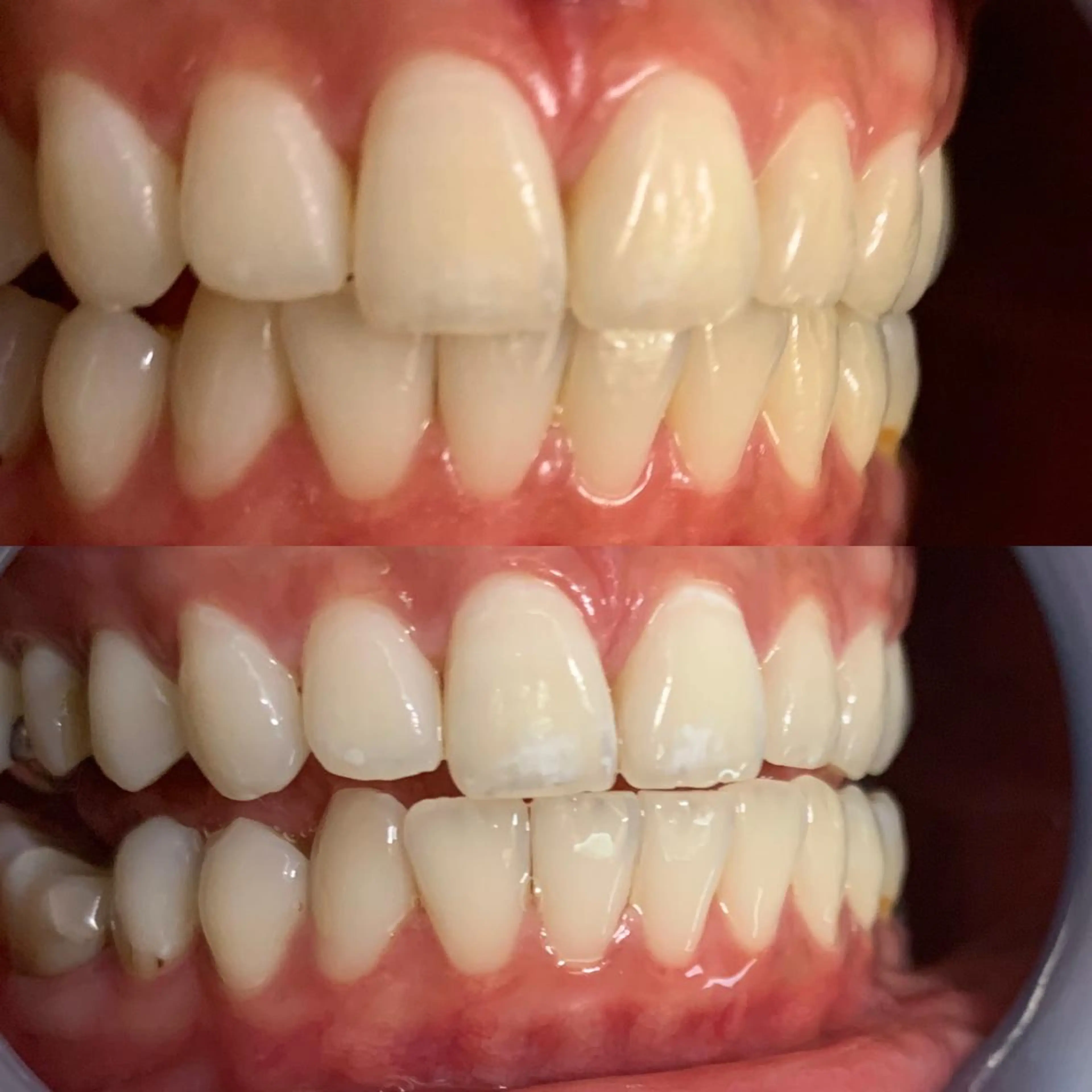 LOVE ホワイトニング新宿店のその他イメージ