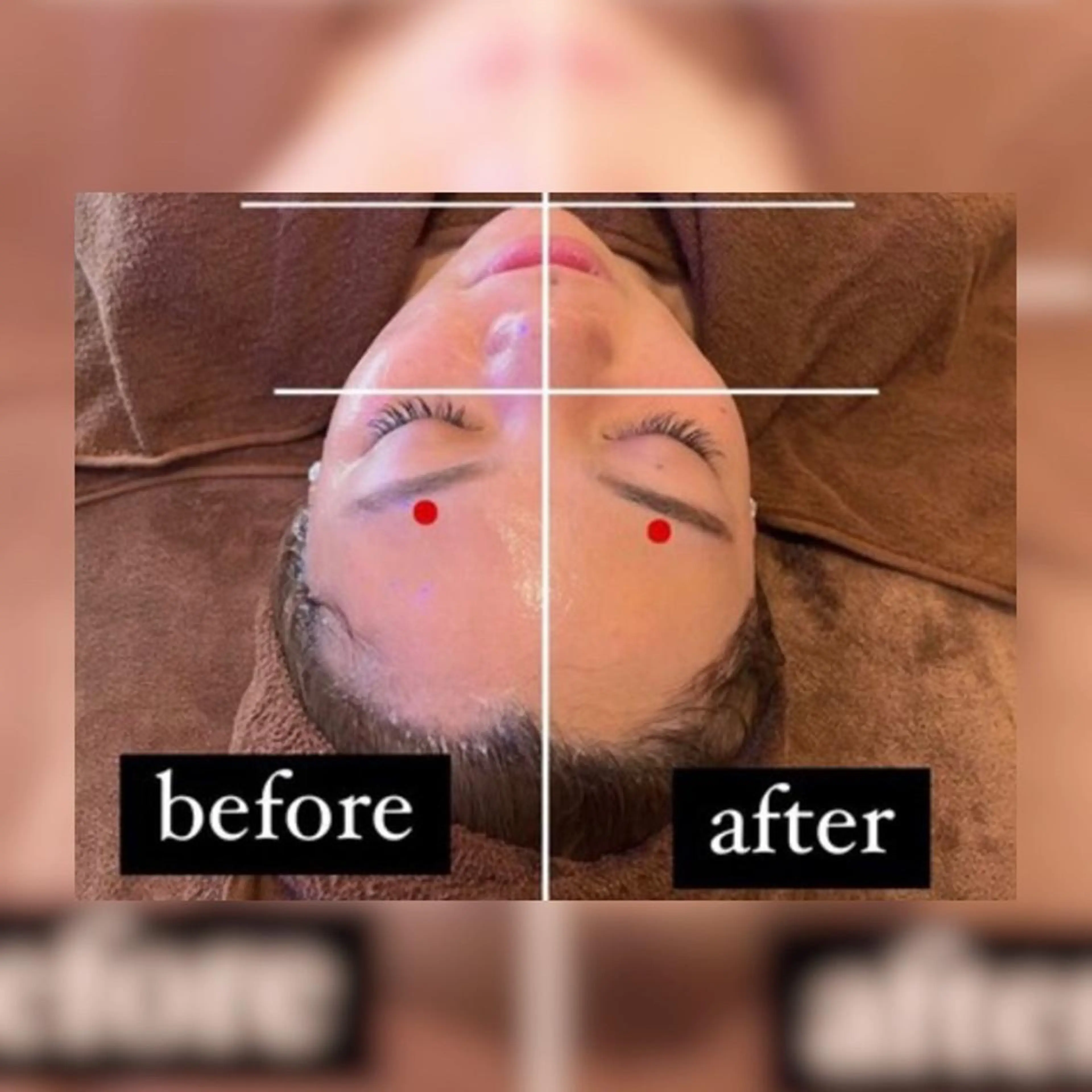 エステ Lam..肌質改善 専門 女性専用サロンのエステ・リラクイメージ