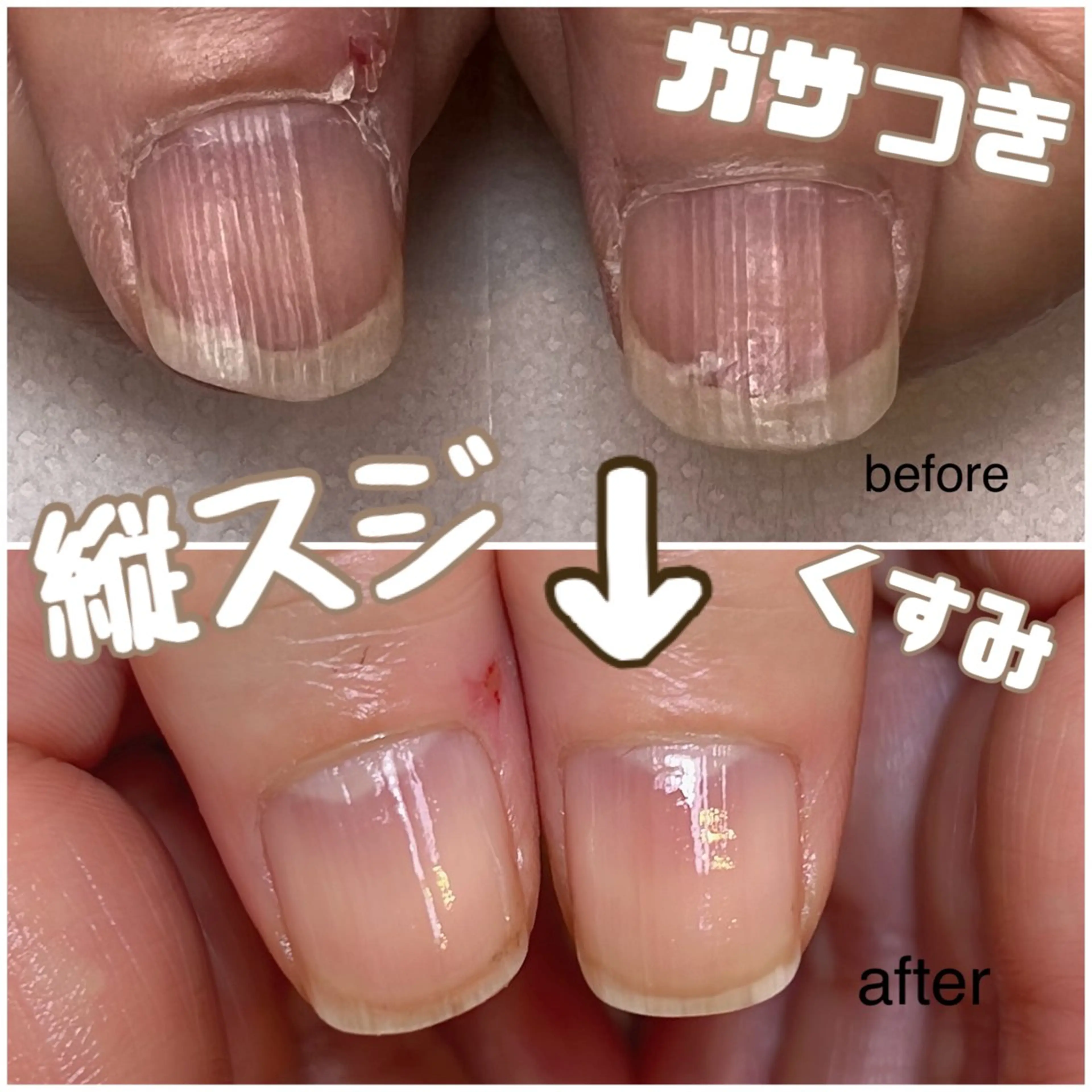 化学品を使わずネイルケアコース【自爪育成】【美爪ケア】の写真