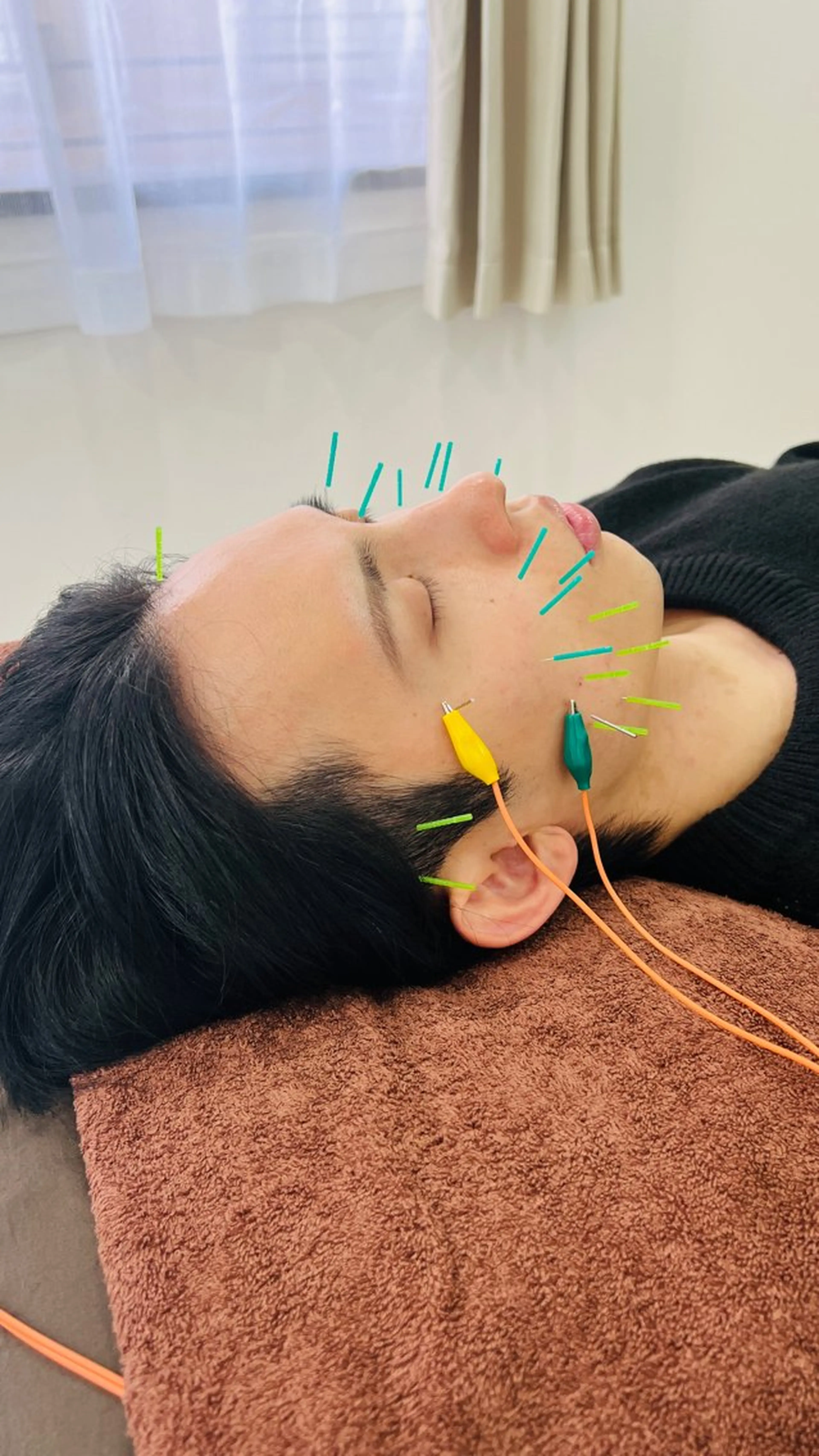 美容鍼×小顔×猫背× ブライダル 大阪梅田のエステ・リラクイメージ