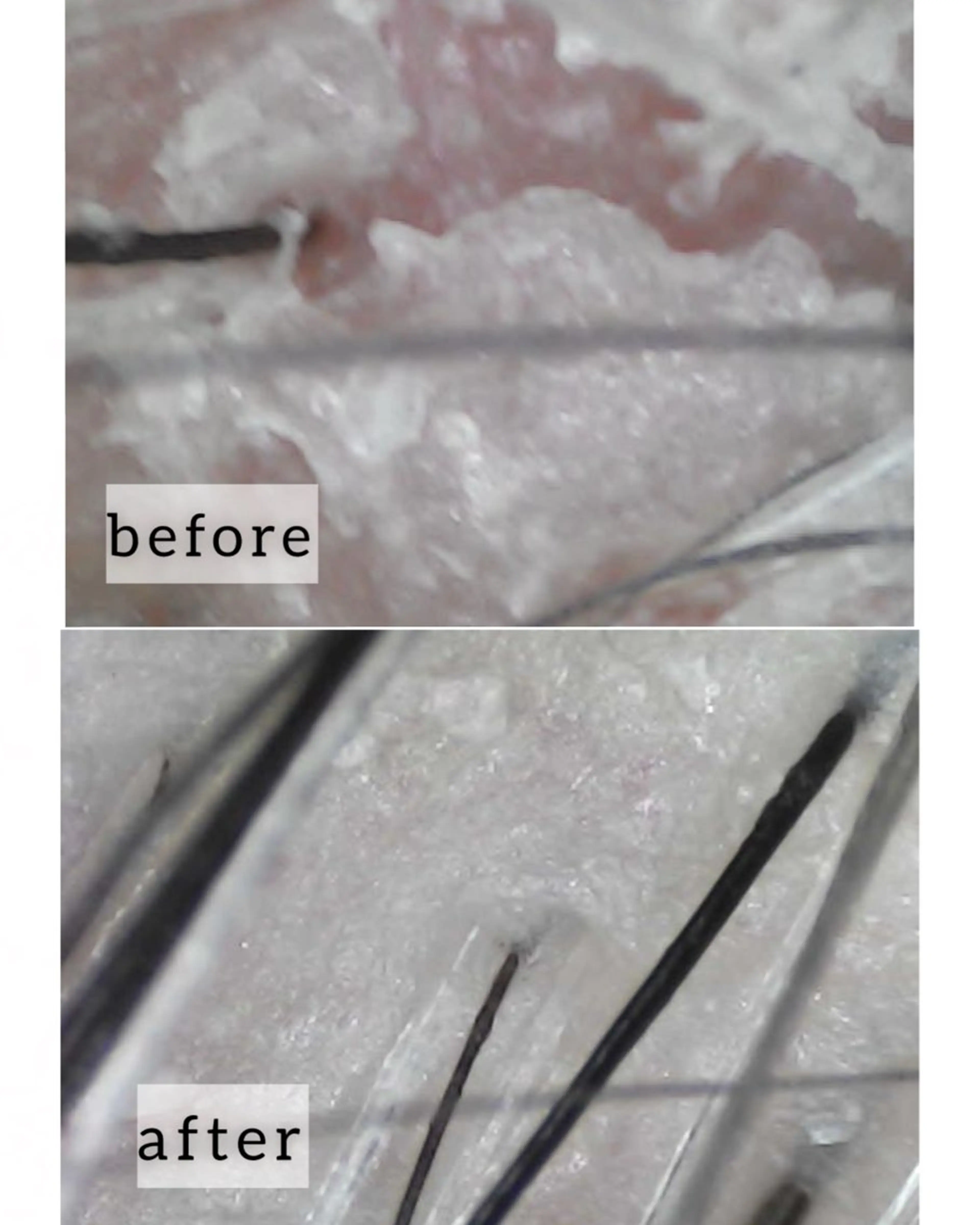 ヘッドスパ salowin 郡山店所属・中畑 莉菜のヘアスタイル