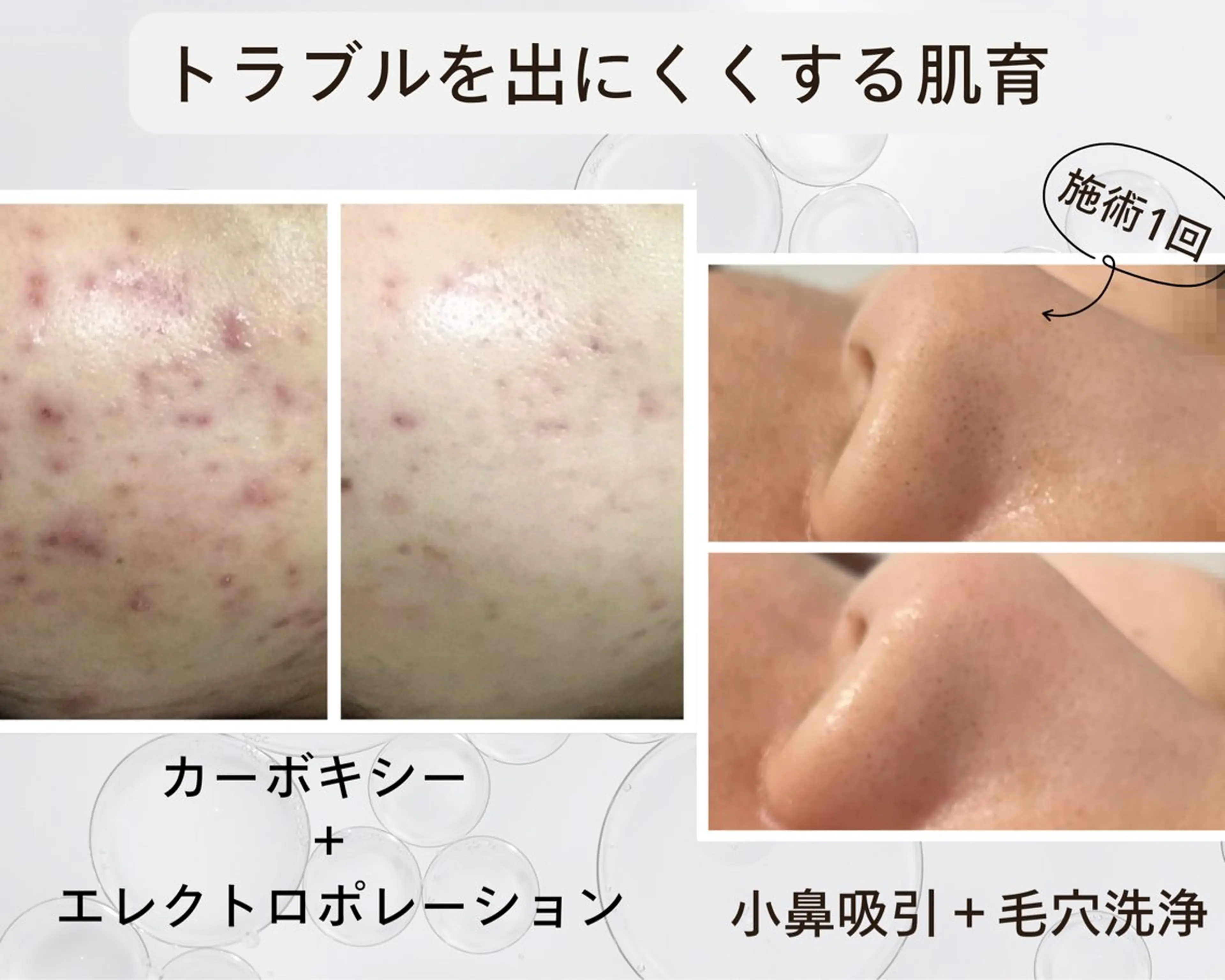 パーソナルサロン iley【アイリー】のエステ・リラクイメージ