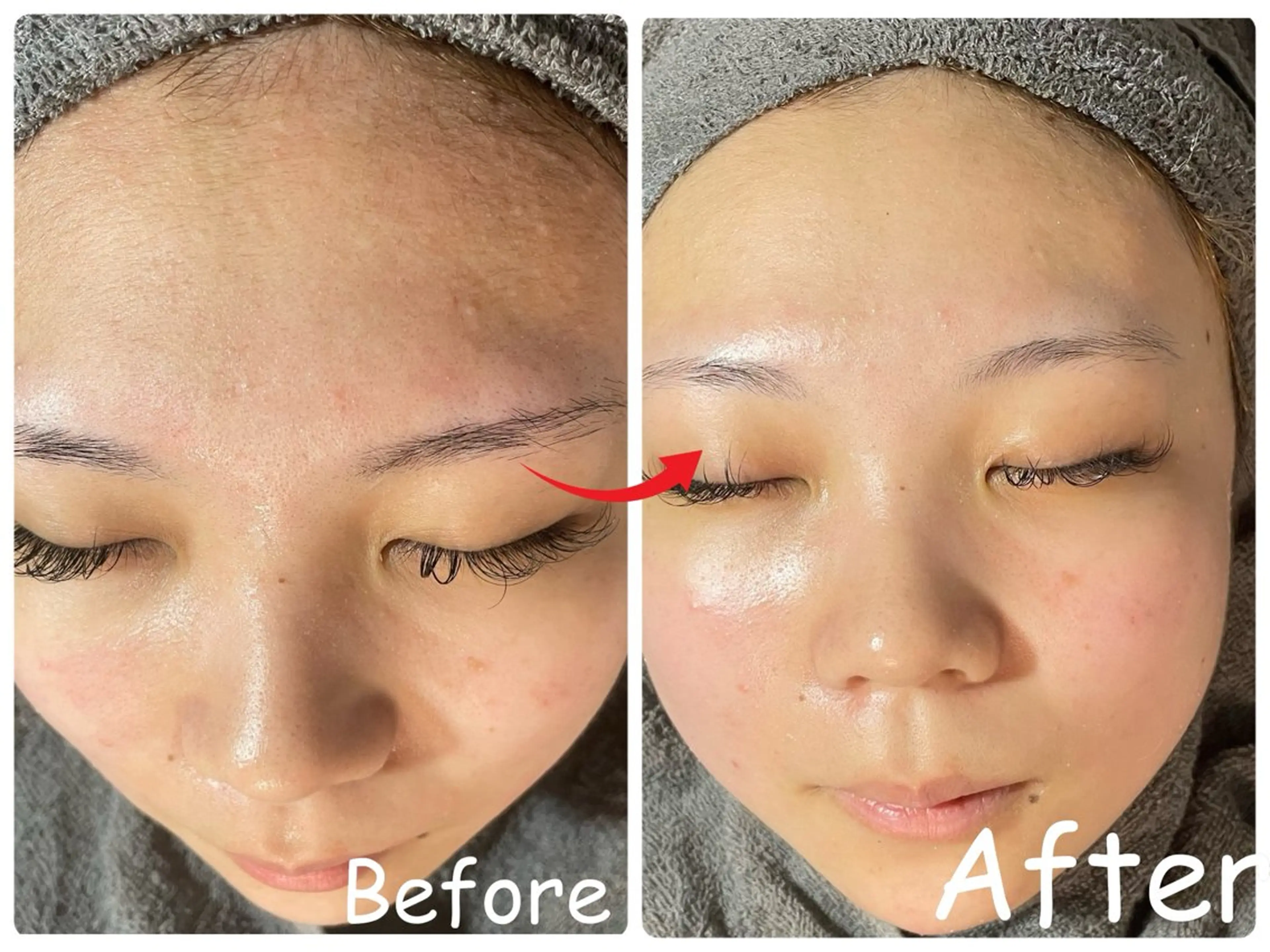 エステ リラク ele"ハーブ ピーリング 専門店のエステ・リラクイメージ