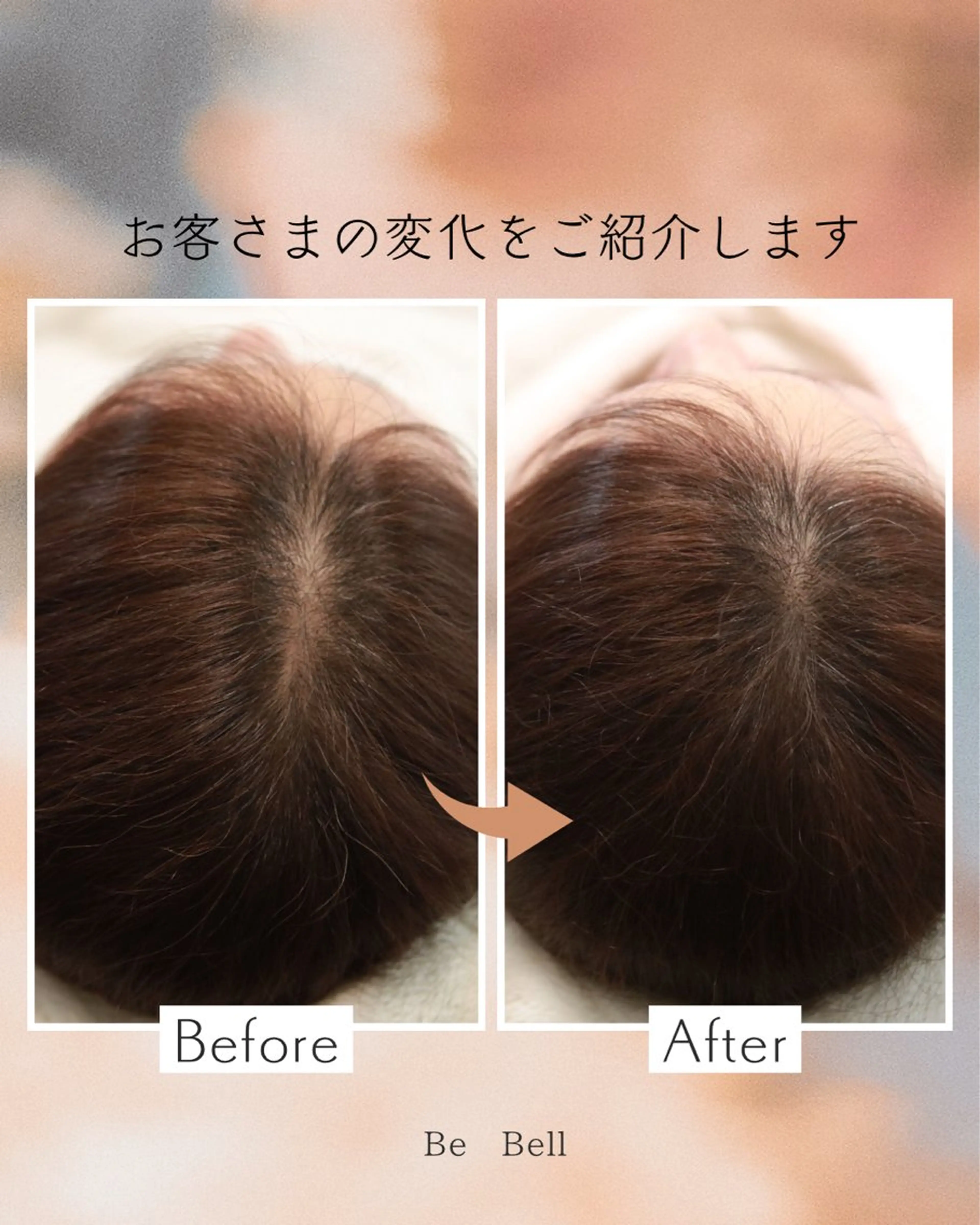 期間限定！ボリューム増毛エクステ（エアエク）500本。ドライヘッドスパ20分付きの写真