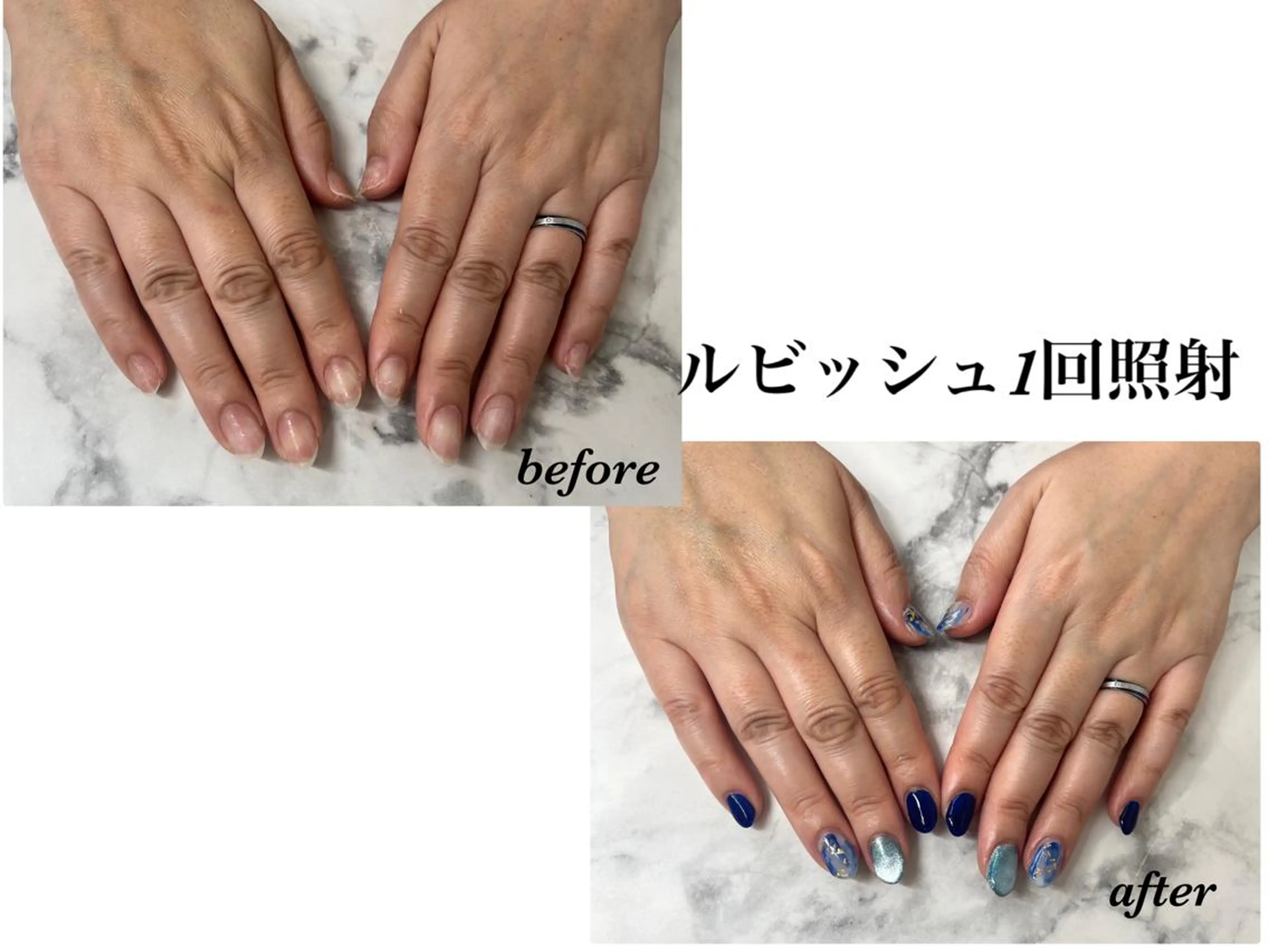 ネイル Regene ARAKIのネイルデザイン