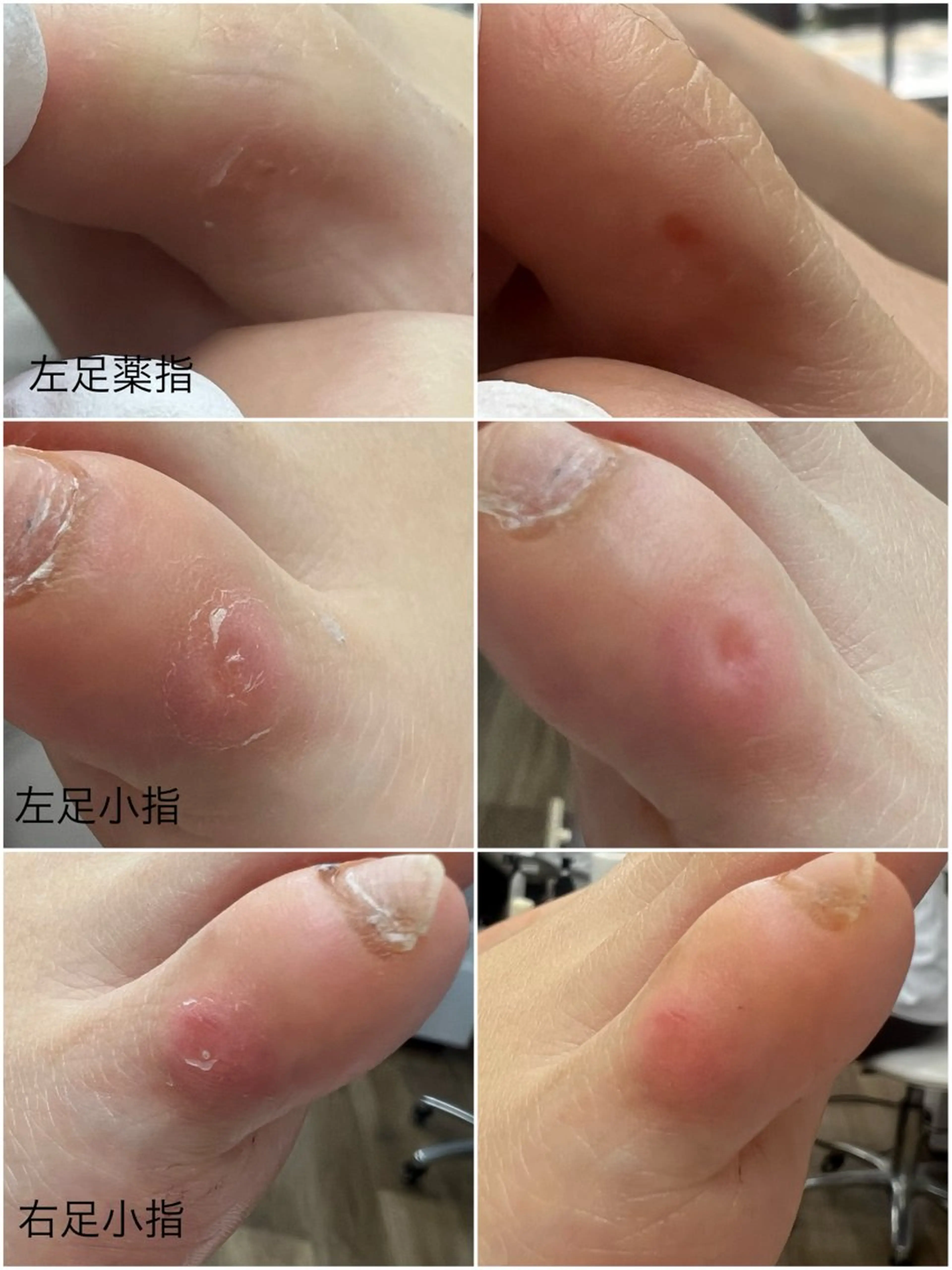 ネイル フットネイル Belulu ベルルのネイルデザイン