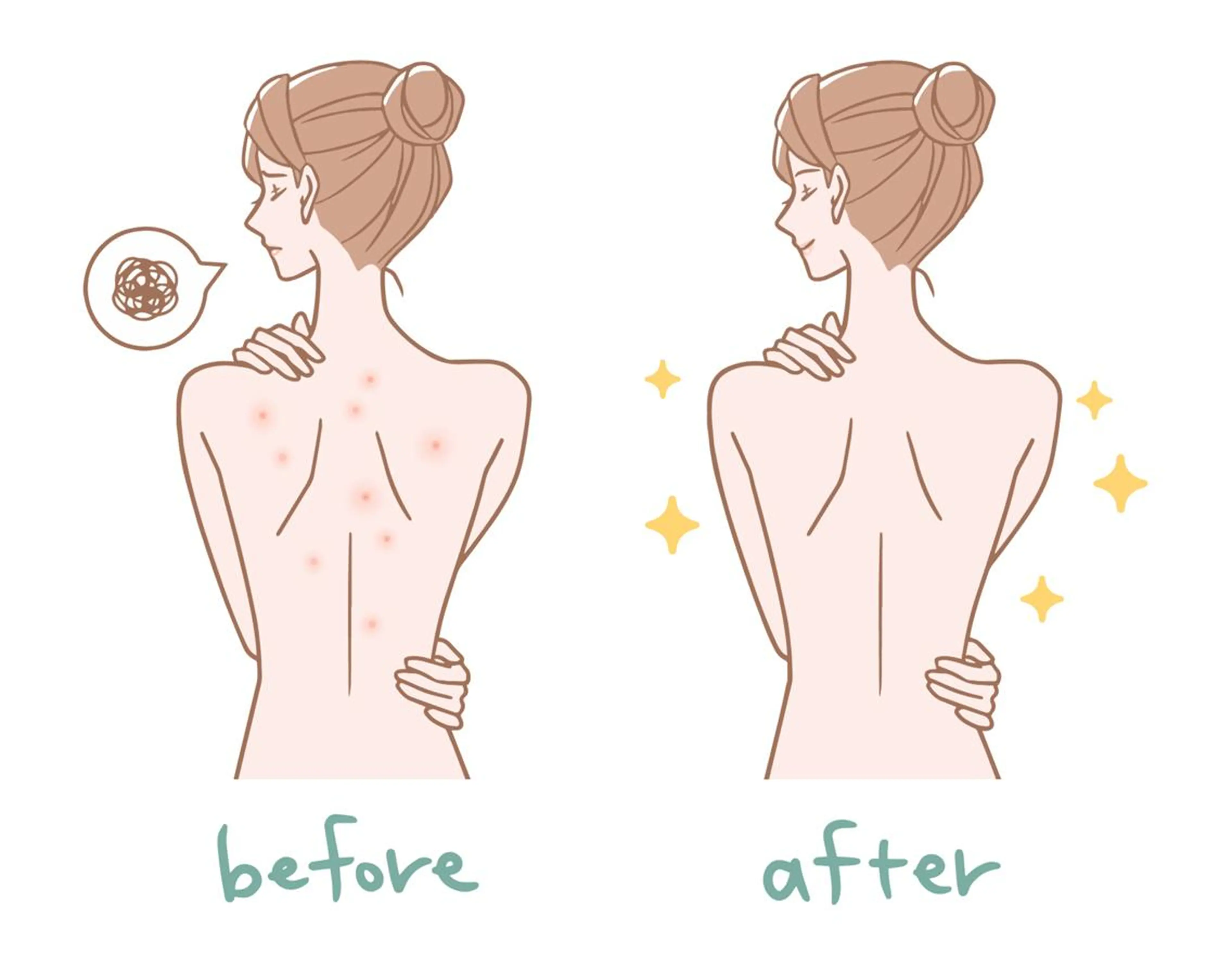 ウエディング専用お背中ピーリングコースの写真