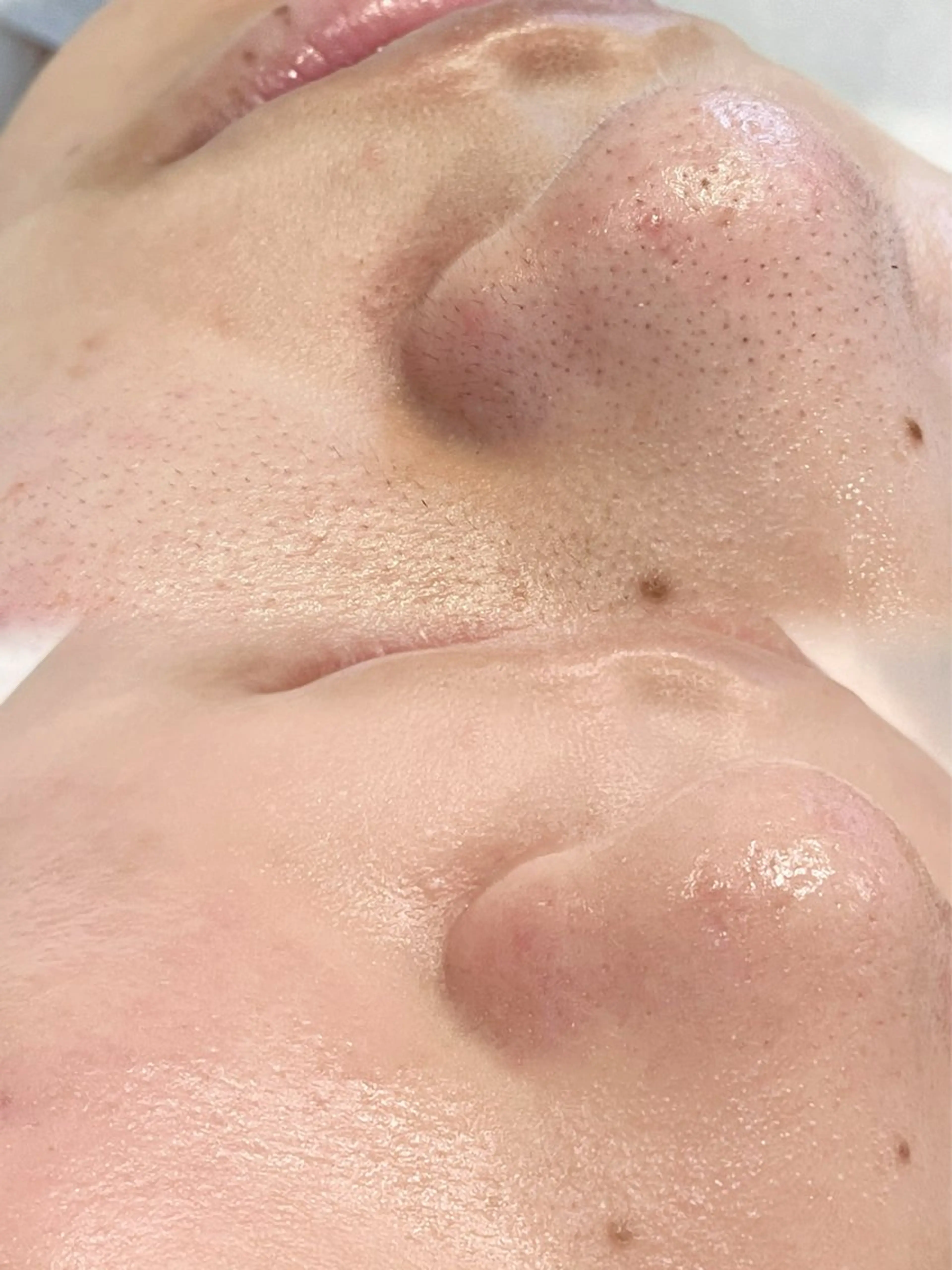 manaka 【lazo】 束本のエステ・リラクイメージ