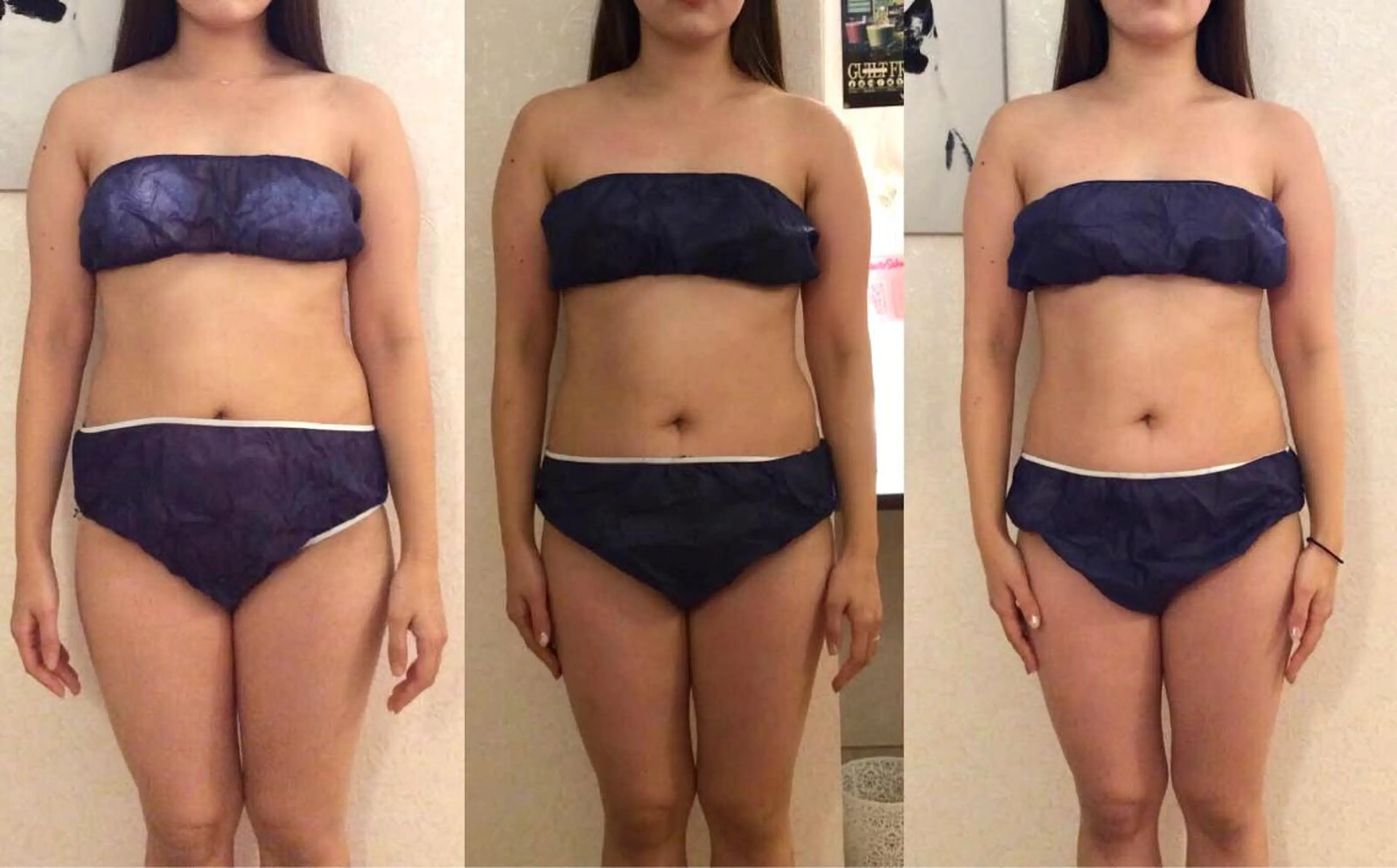 エステ リラク Diamedel所属・柴田 知里のエステ・リラクイメージ