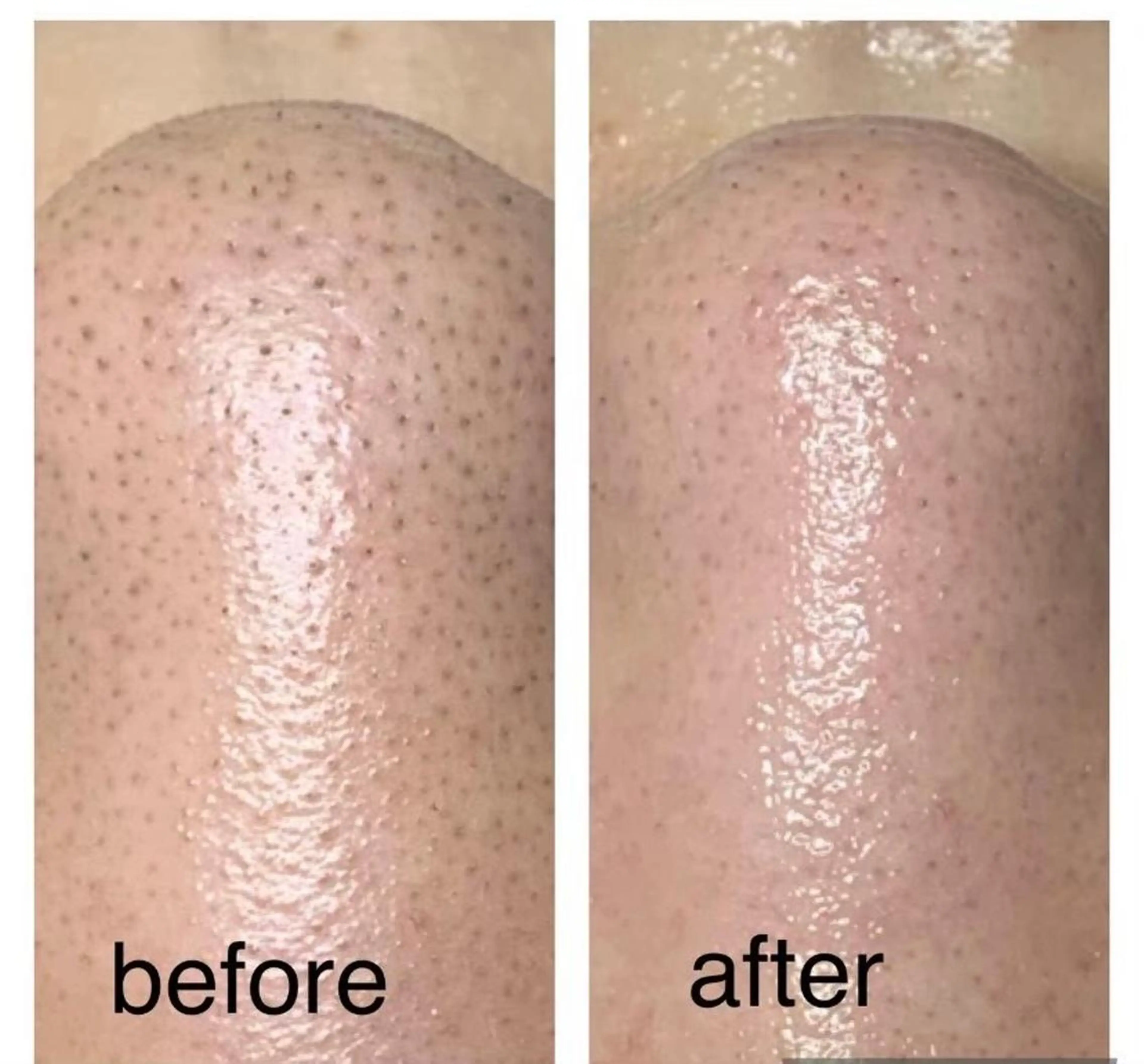 エステ hapi_chura 《ハピちゅら》のエステ・リラクイメージ