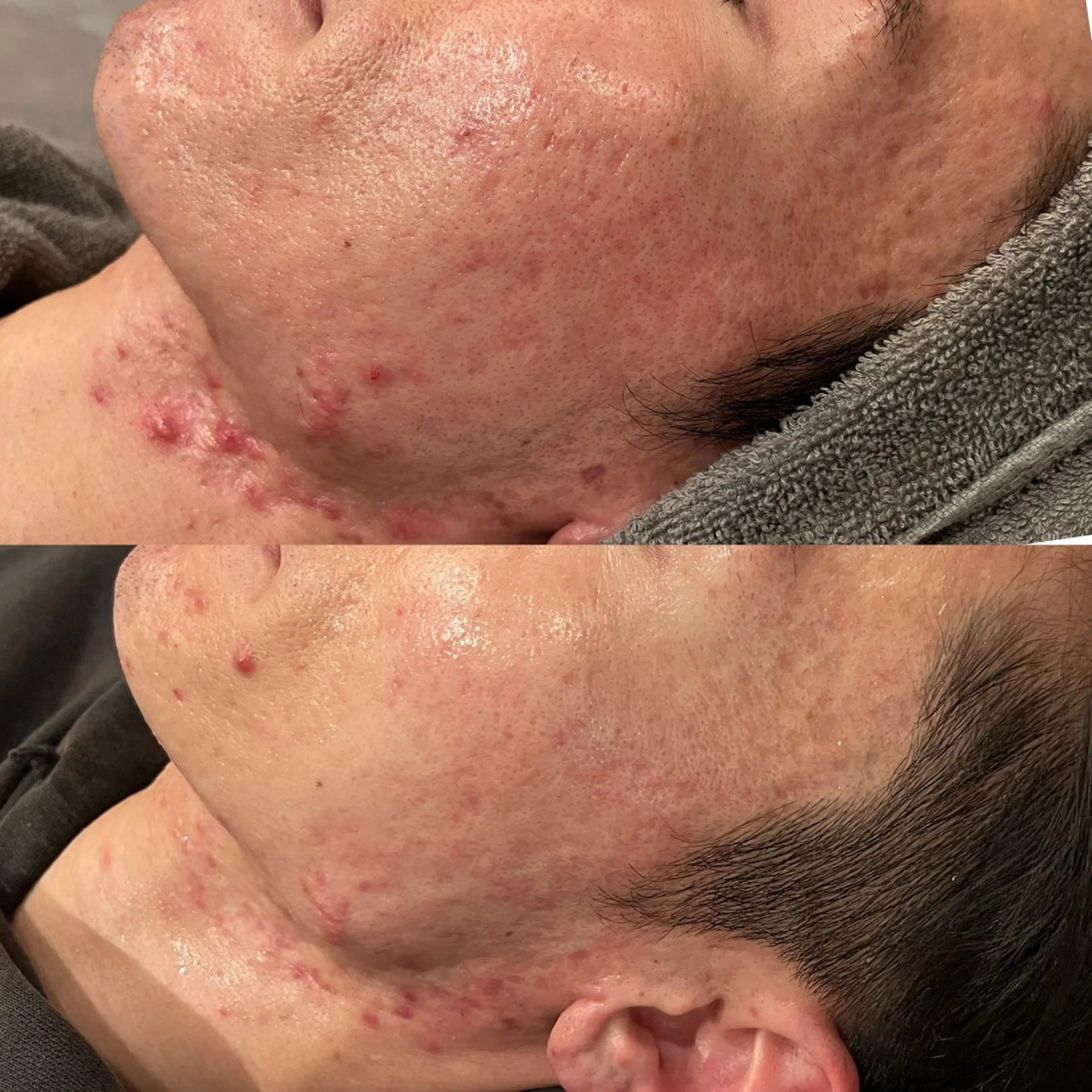 脱毛 yellow💛【 脱毛&フェイシャル】のエステ・リラクイメージ