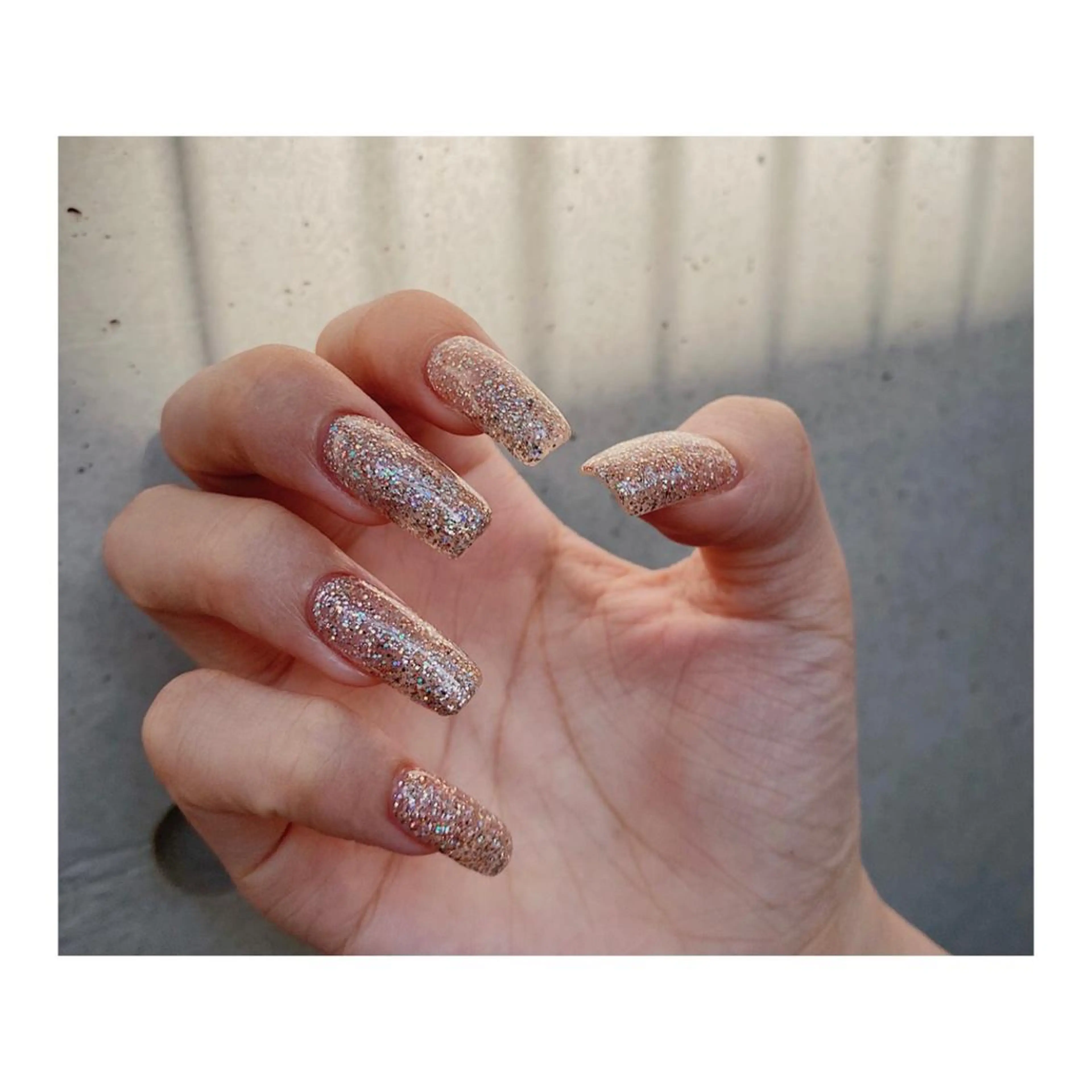 スカルプ長さ出しスタンダートの写真