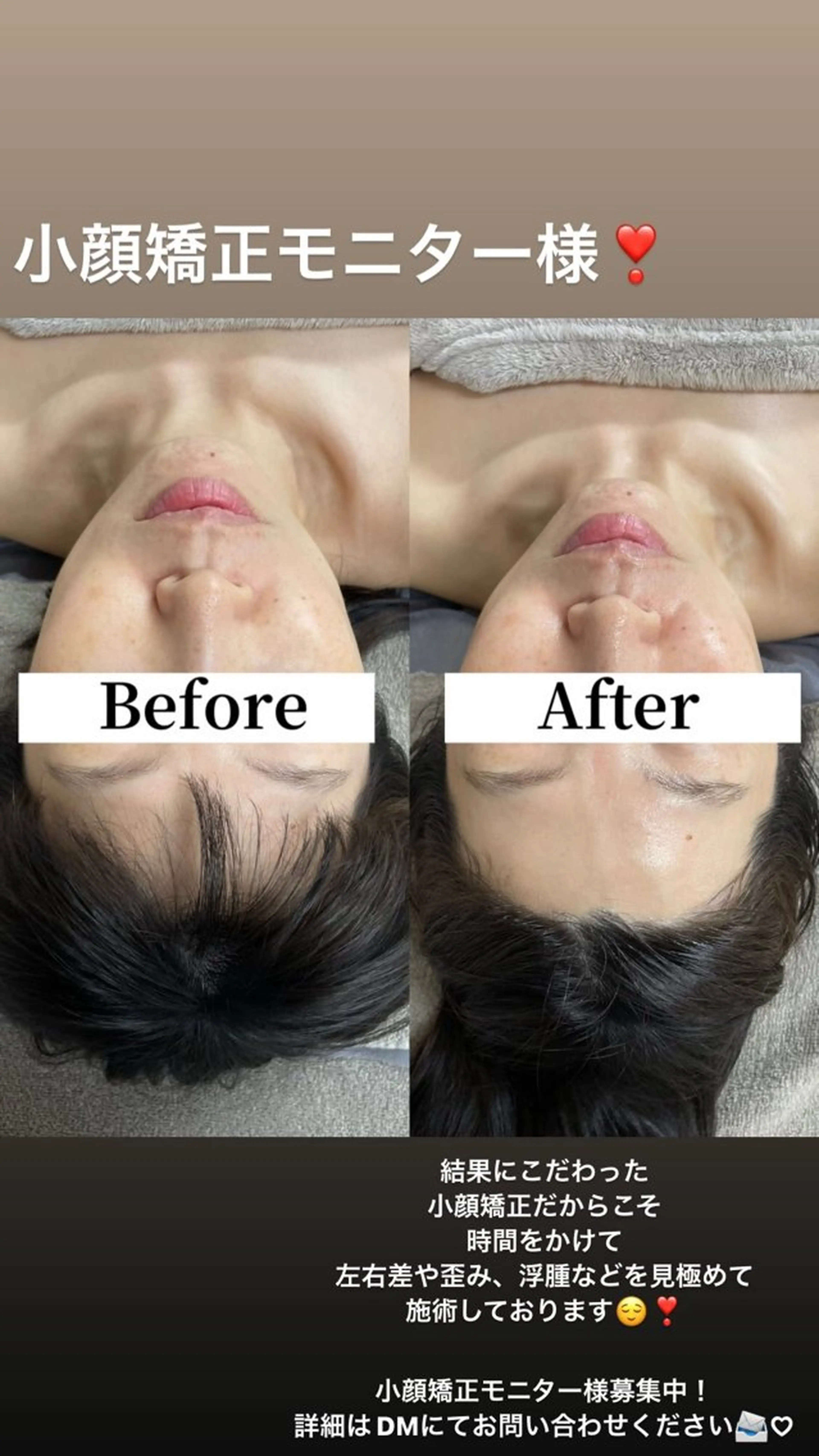 エステ amber(アンバー)所属・プライベートサロン amberのエステ・リラクイメージ