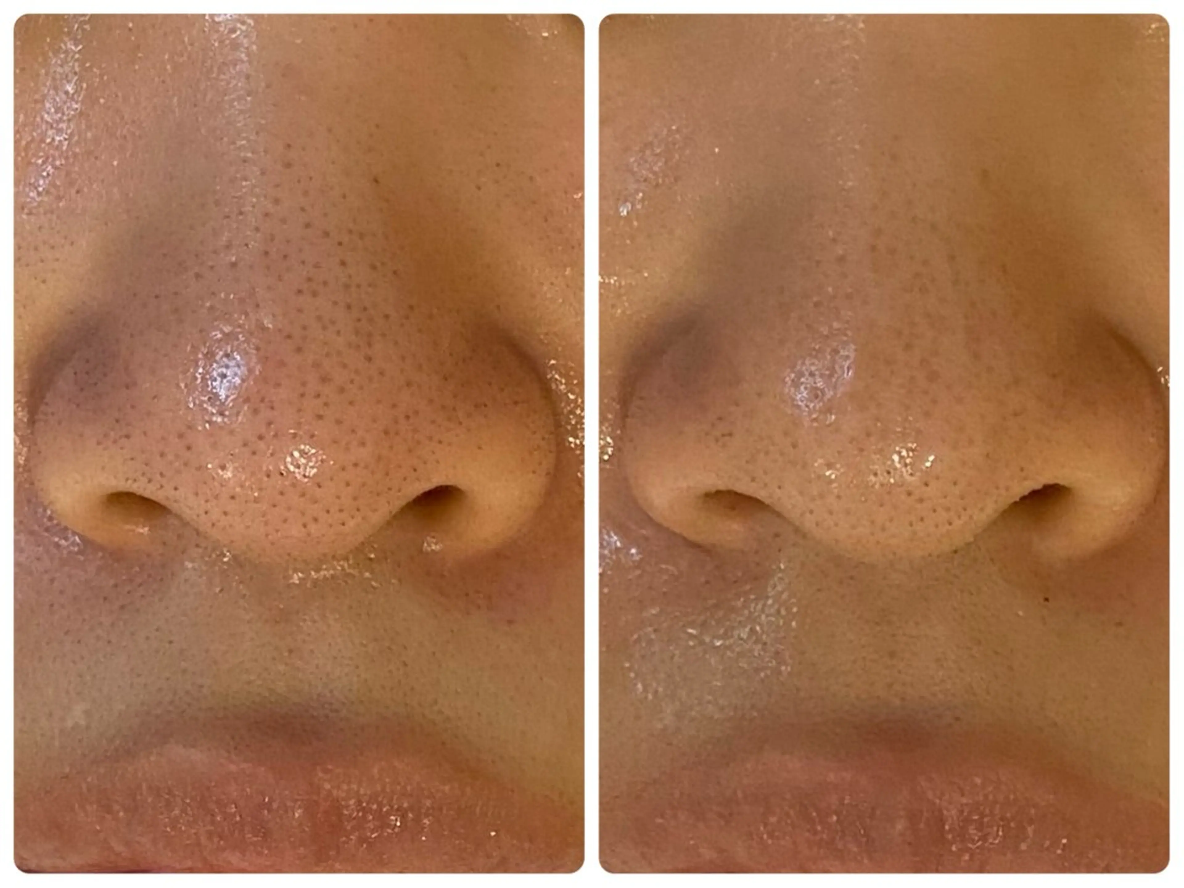 ハーブピーリング🌿 脱毛🧡ヘッドスパのエステ・リラクイメージ