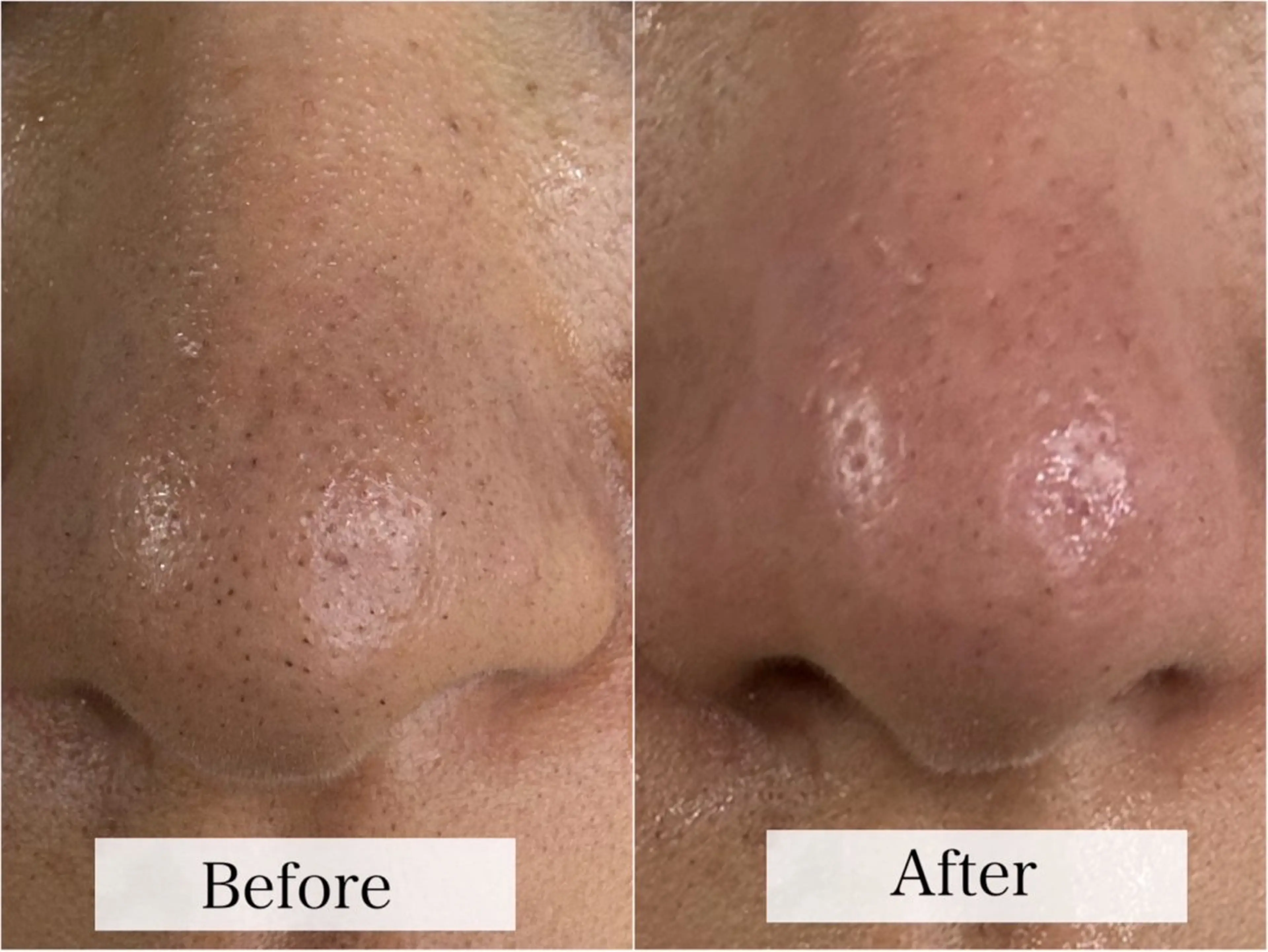 エステ リラク kogao&head Linoasのエステ・リラクイメージ