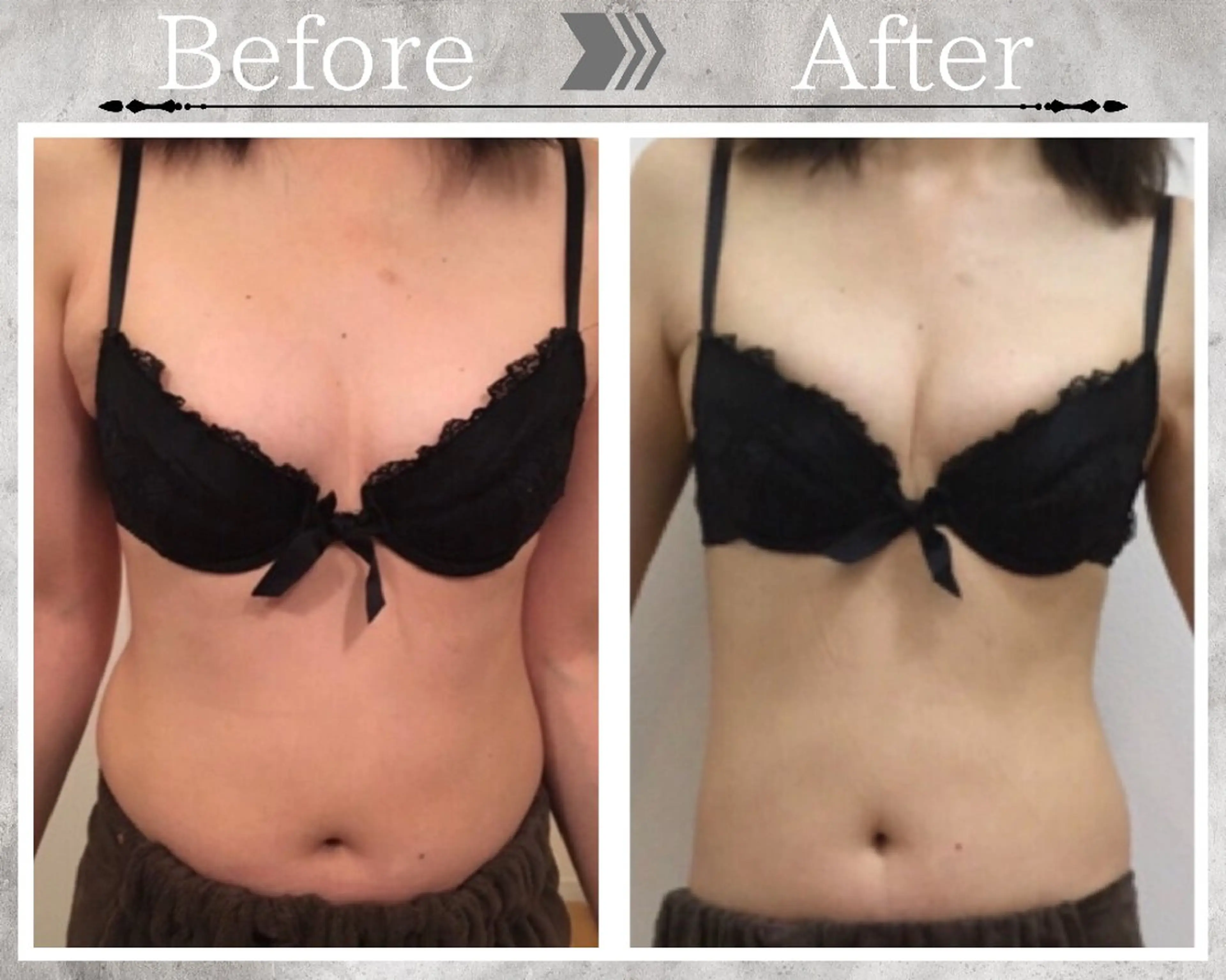 その他 【バストケアサロン】 Feliz フェリスのエステ・リラクイメージ