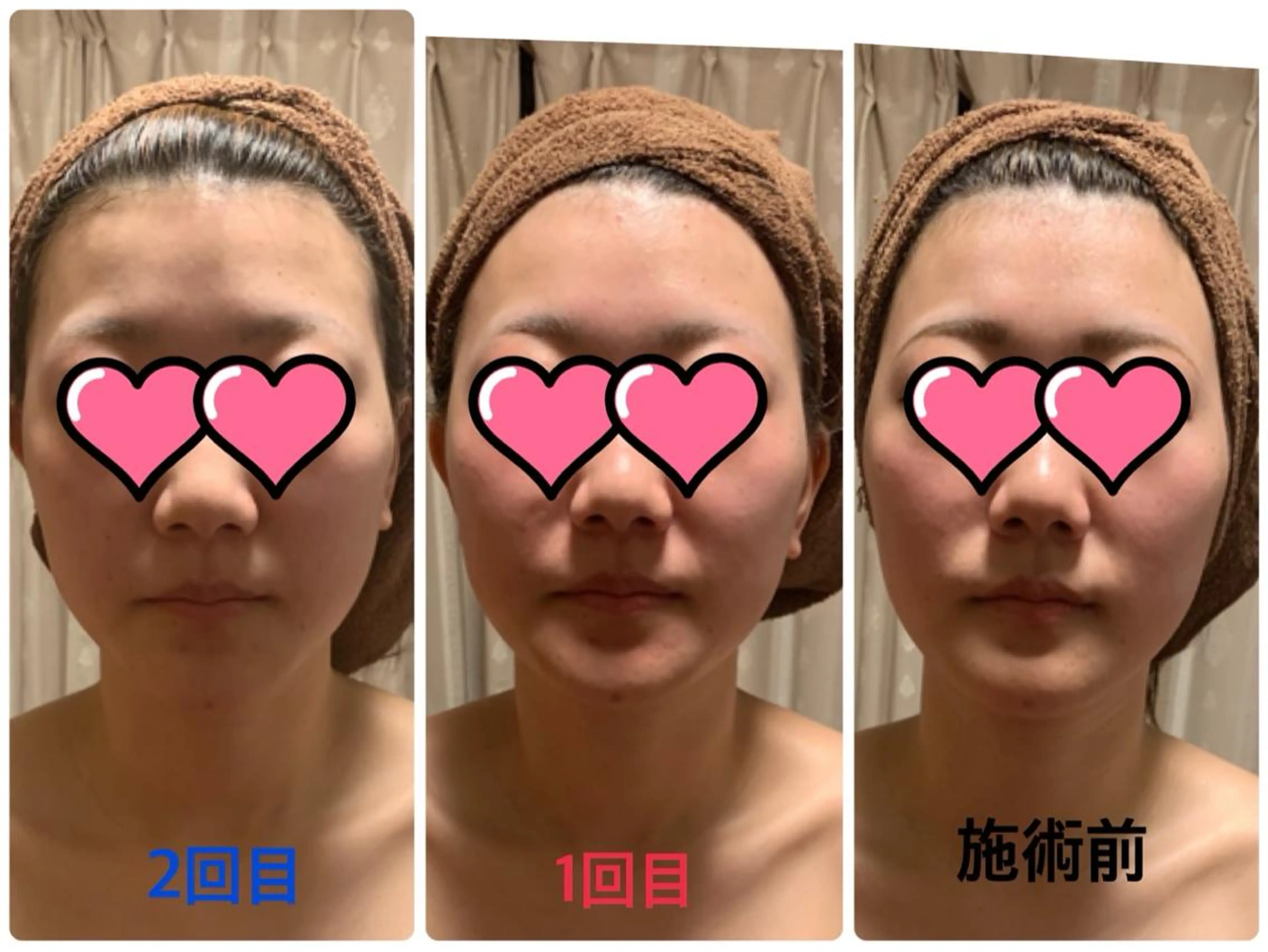 エステ リラク 柳澤 歩のその他イメージ