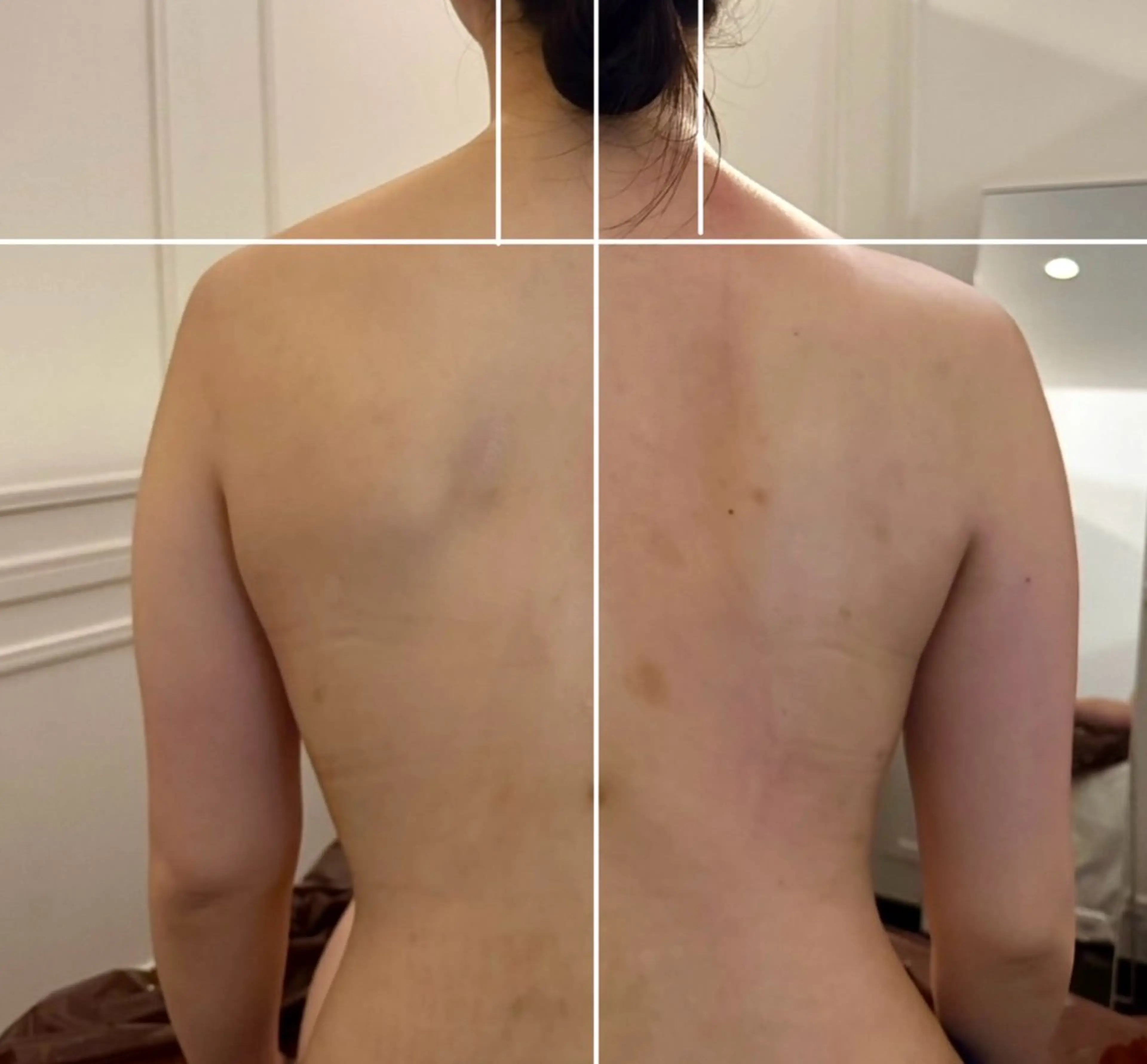 エステ リラク 小顔EX心斎橋 REVIハーブのエステ・リラクイメージ