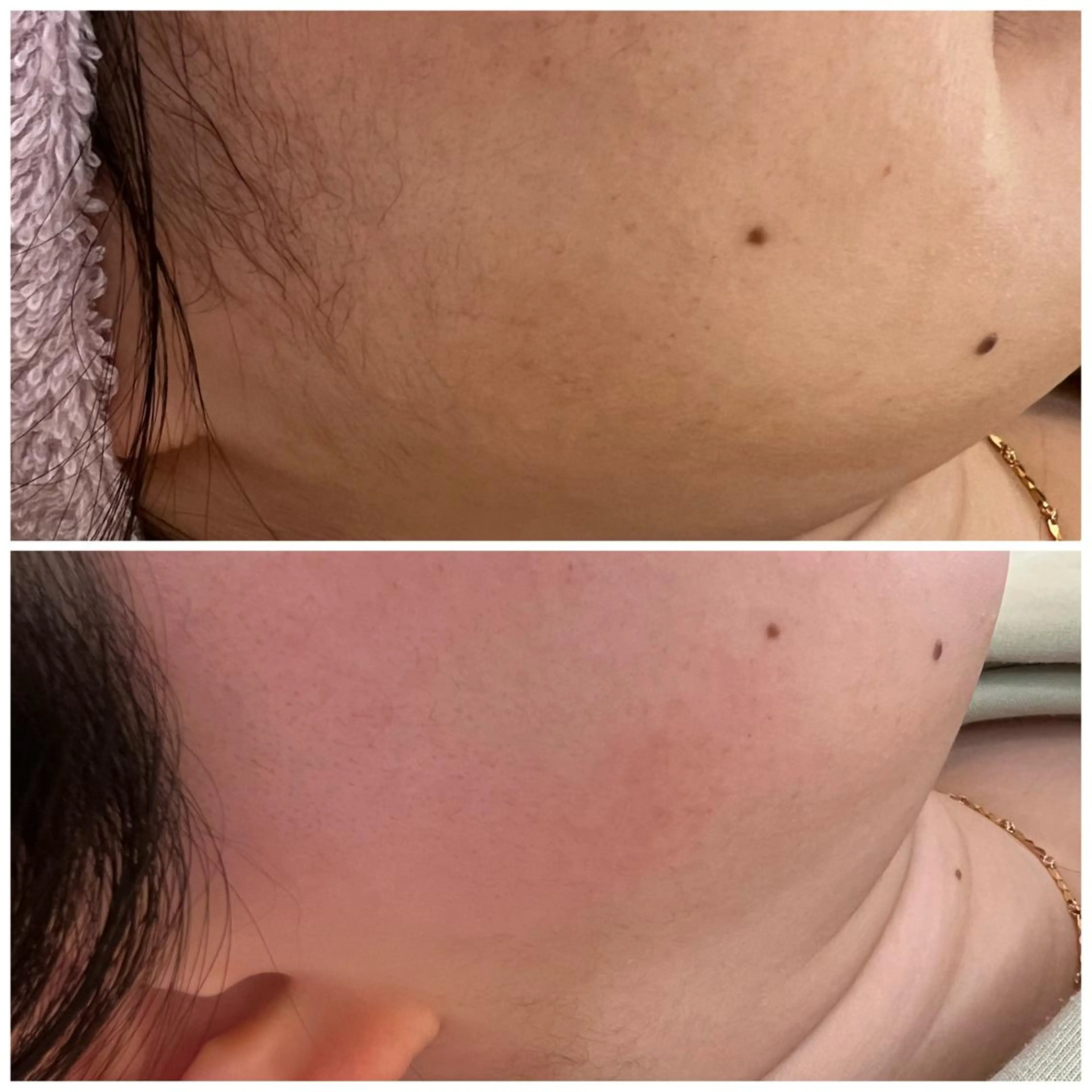 Dimples eyelashのエステ・リラクイメージ