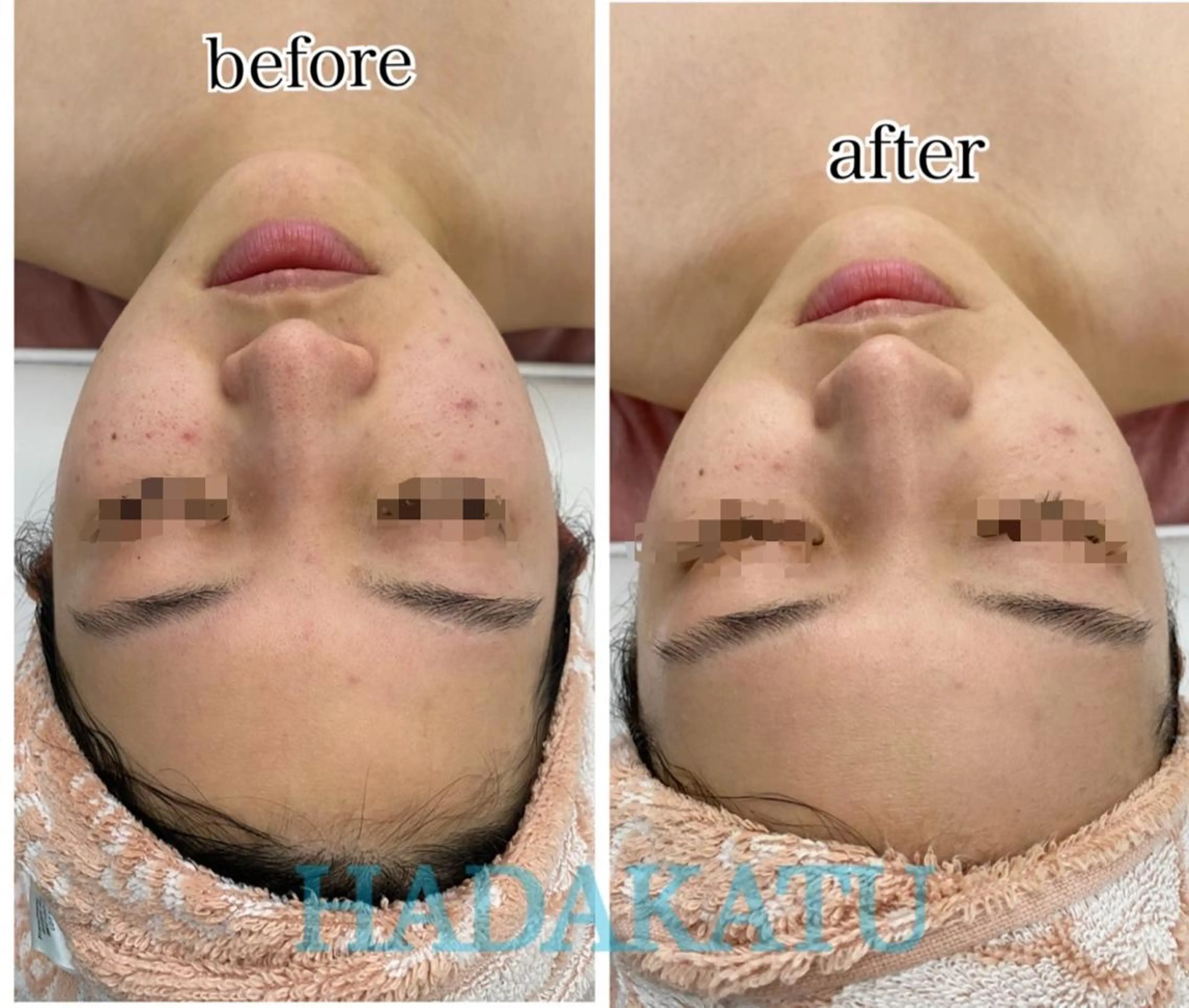 総合エステサロン 肌活のエステ・リラクイメージ