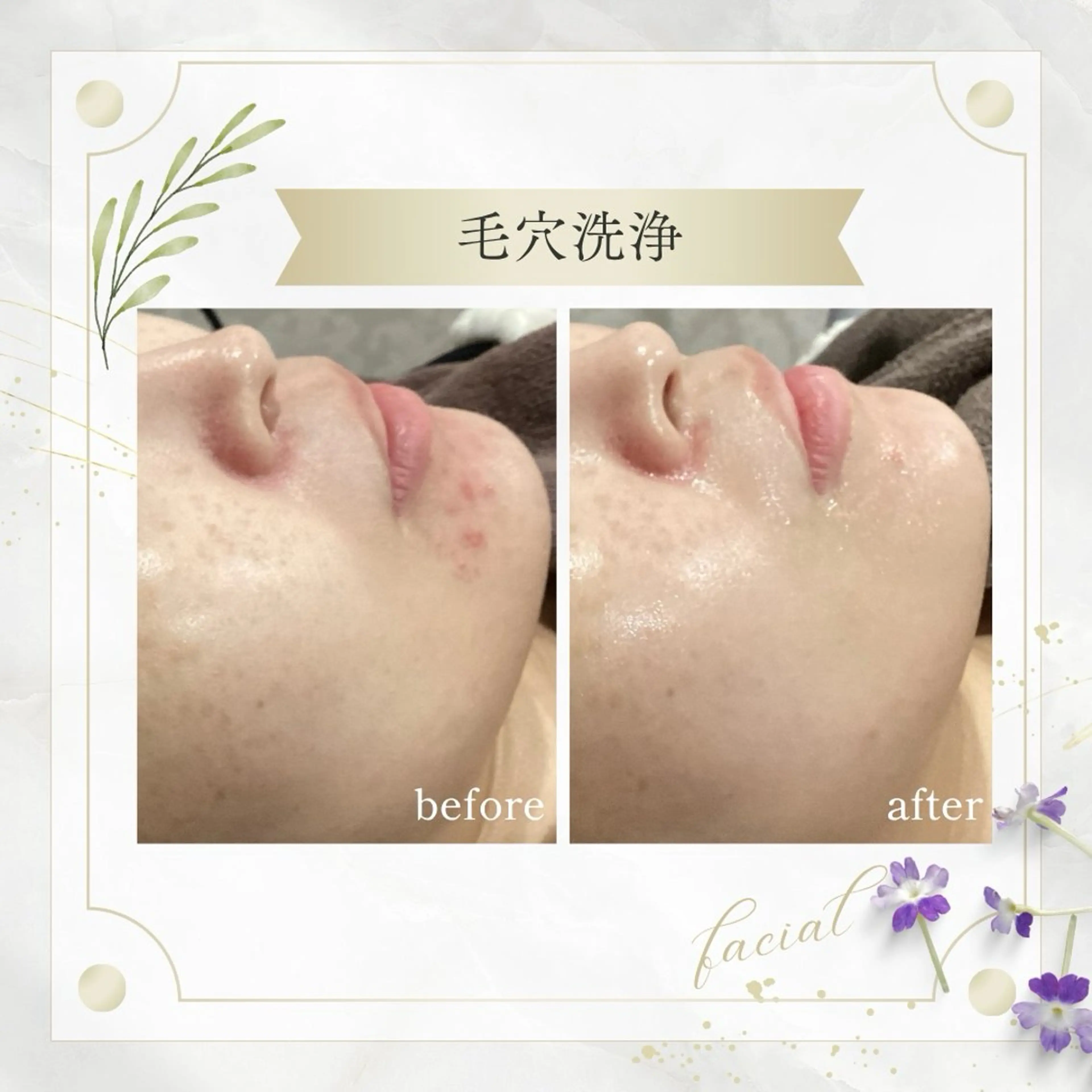 《 肌質×美肌 》 addissimoのエステ・リラクイメージ