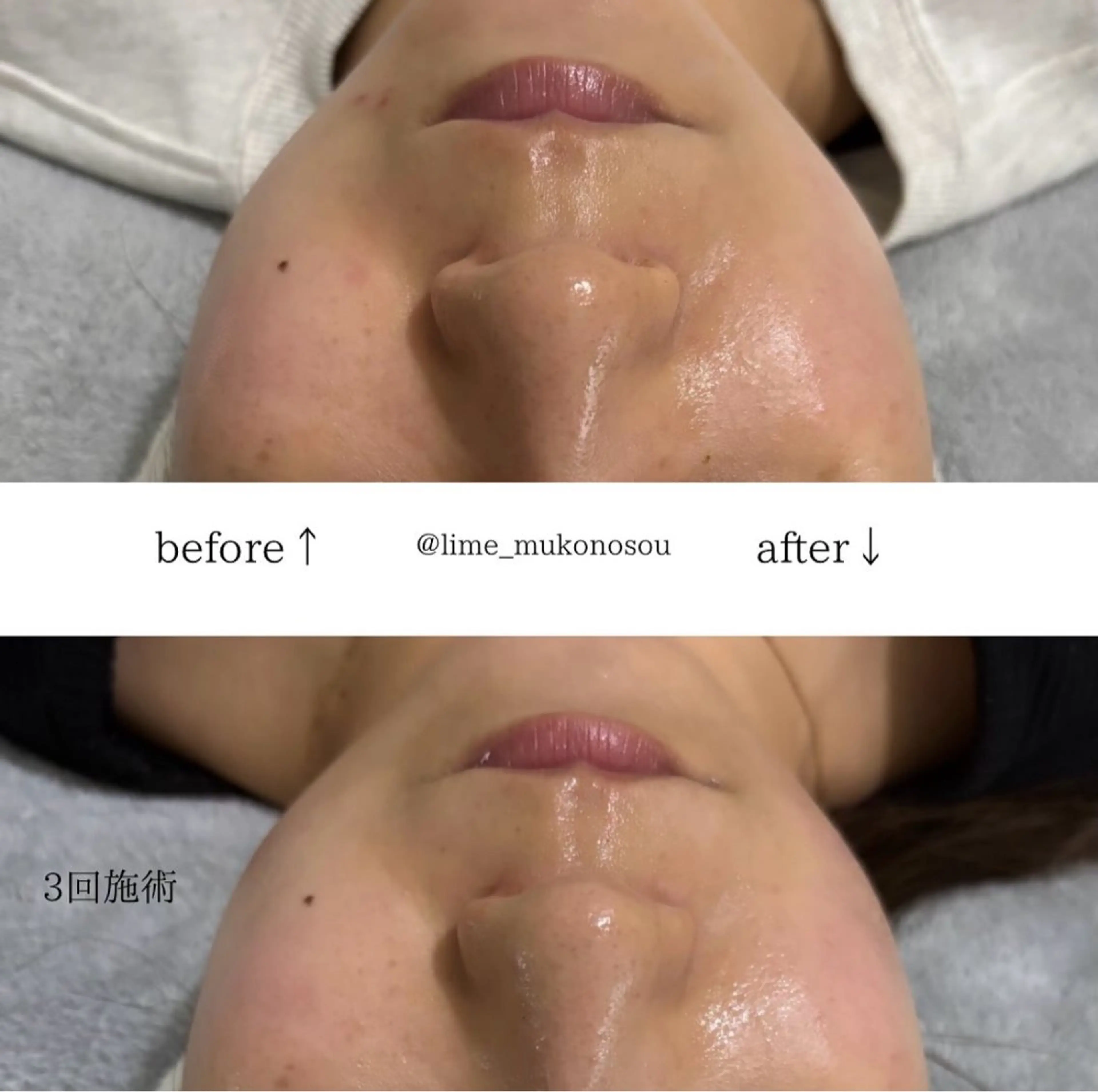 エステ LIME 武庫之荘店のエステ・リラクイメージ