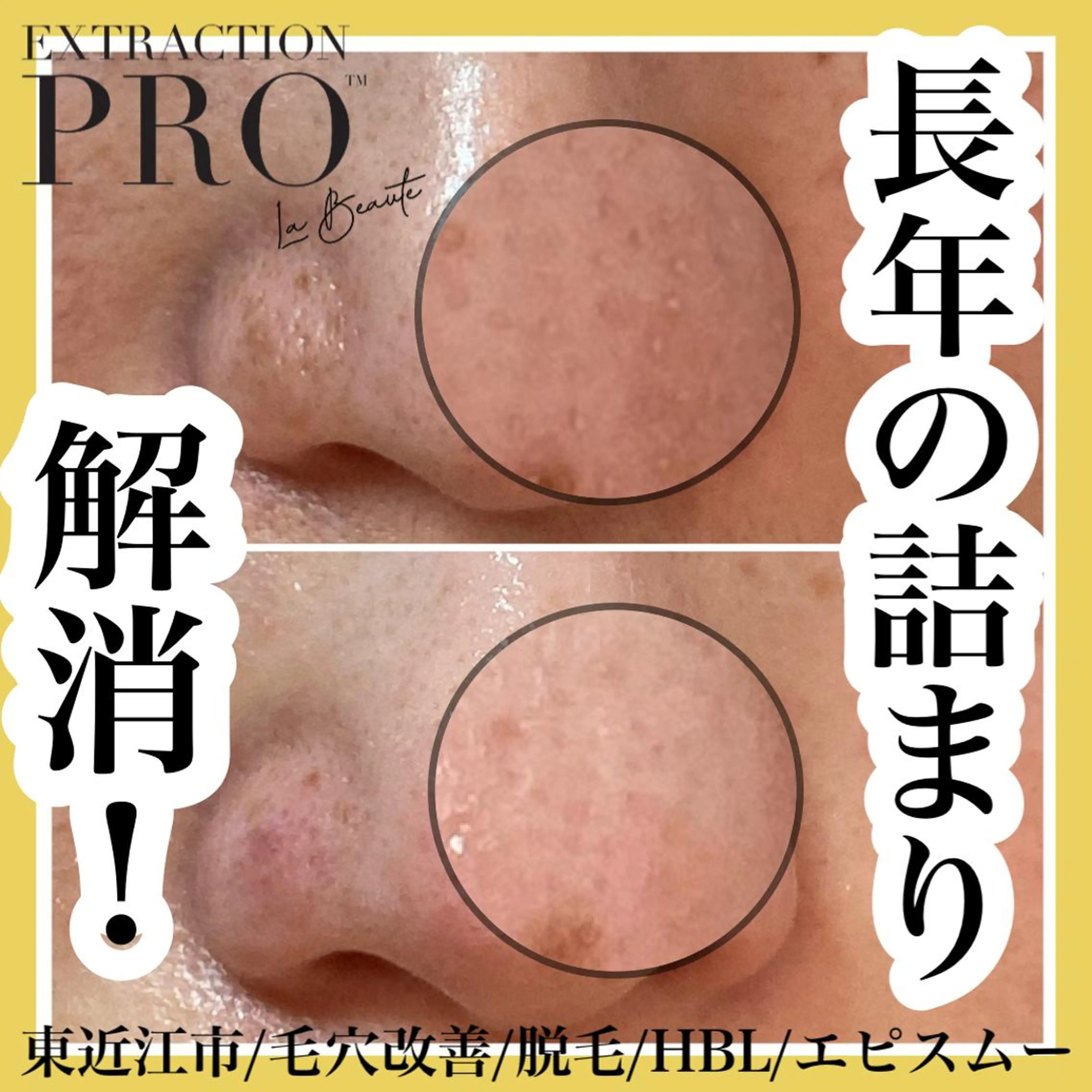 epismoo 脱毛/HBL/毛穴の眉毛・アイブロウイメージ