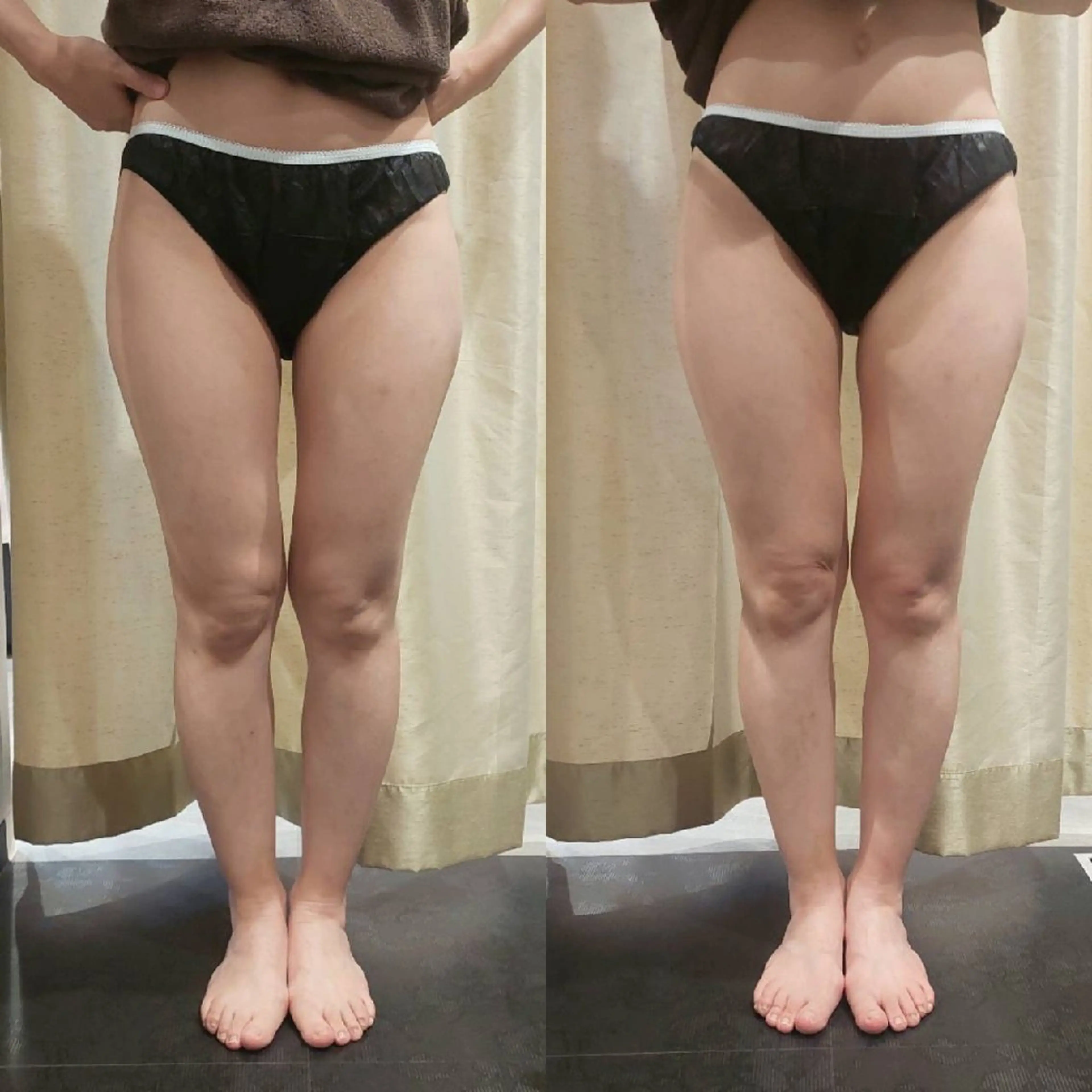 エステ リラク MyFairLady miuのエステ・リラクイメージ